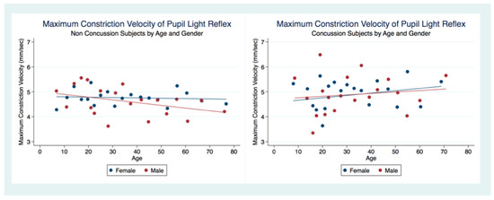 The Pupillary Light Reflex as a Biomarker of Concussion