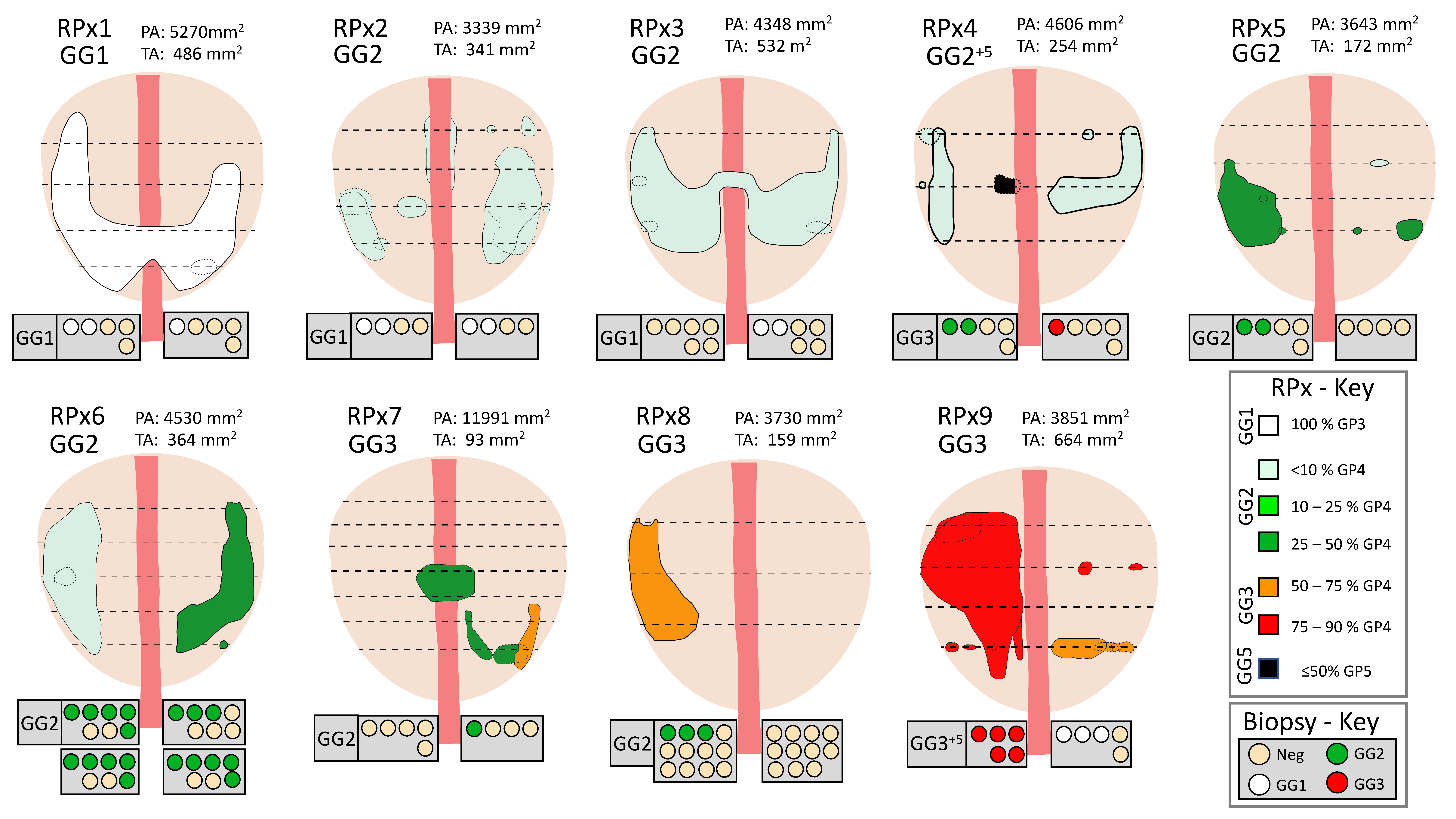 pur test prostate cost