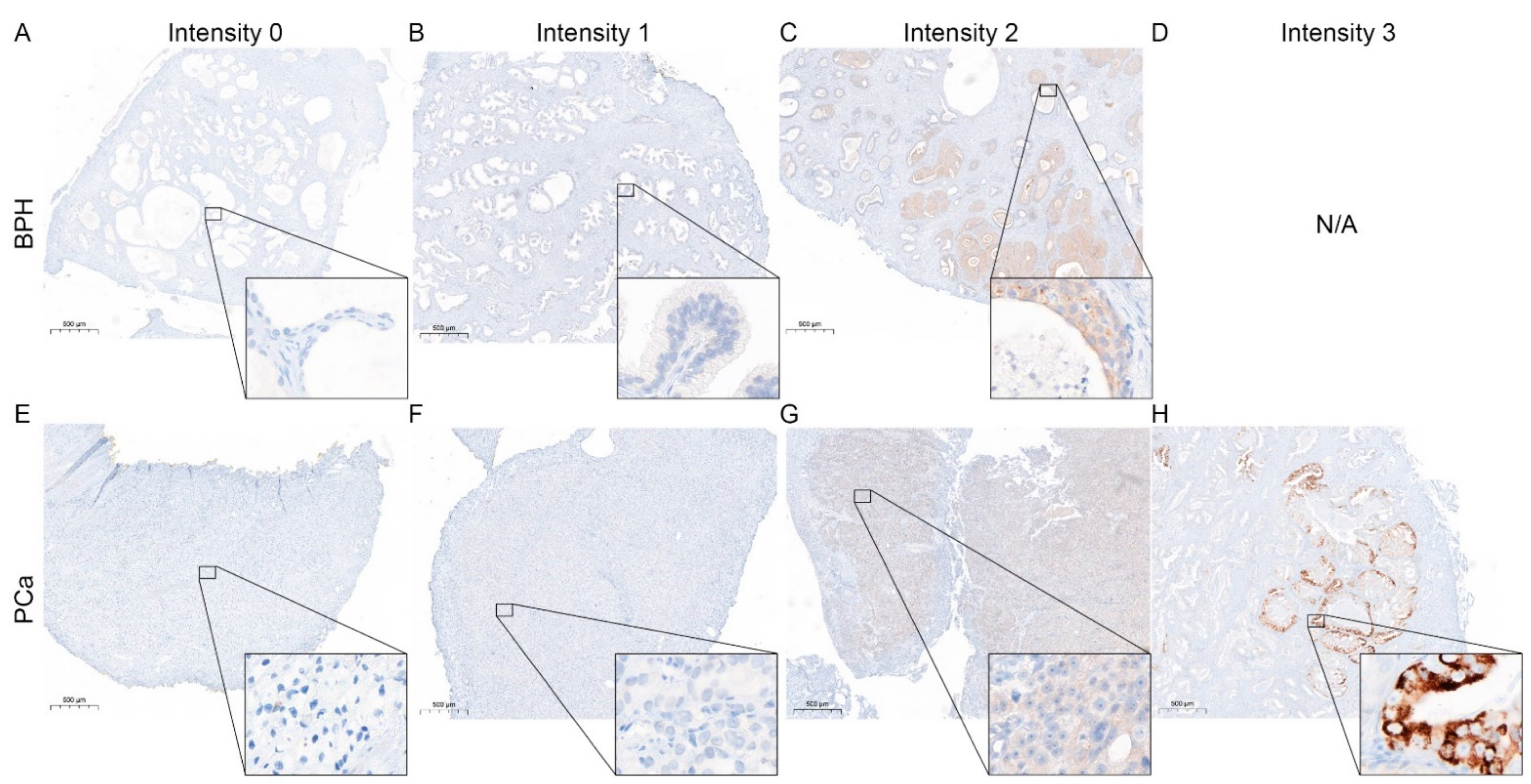 Life Free Full Text Influence Of Systemic Therapy On The Expression And Activity Of Selected Stat Proteins In Prostate Cancer Tissue Html