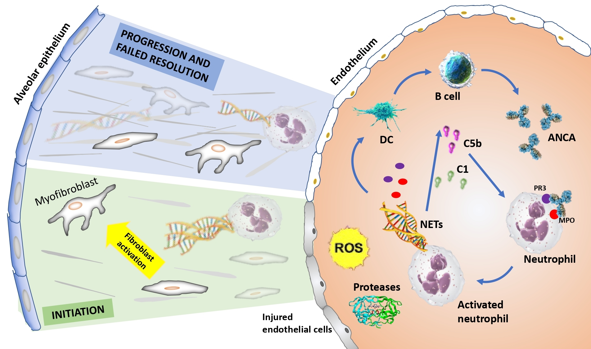 Life Free FullText Neutrophil Extracellular Traps in ANCA