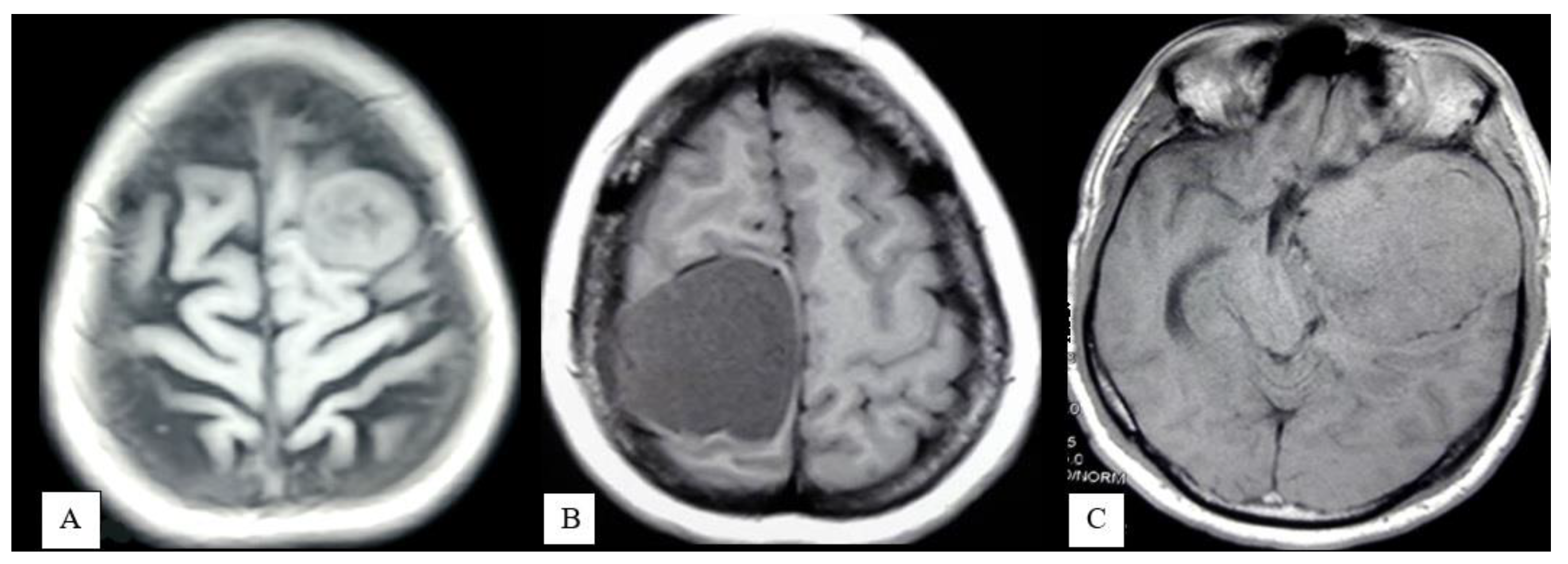 Life 12 00473 g001 550