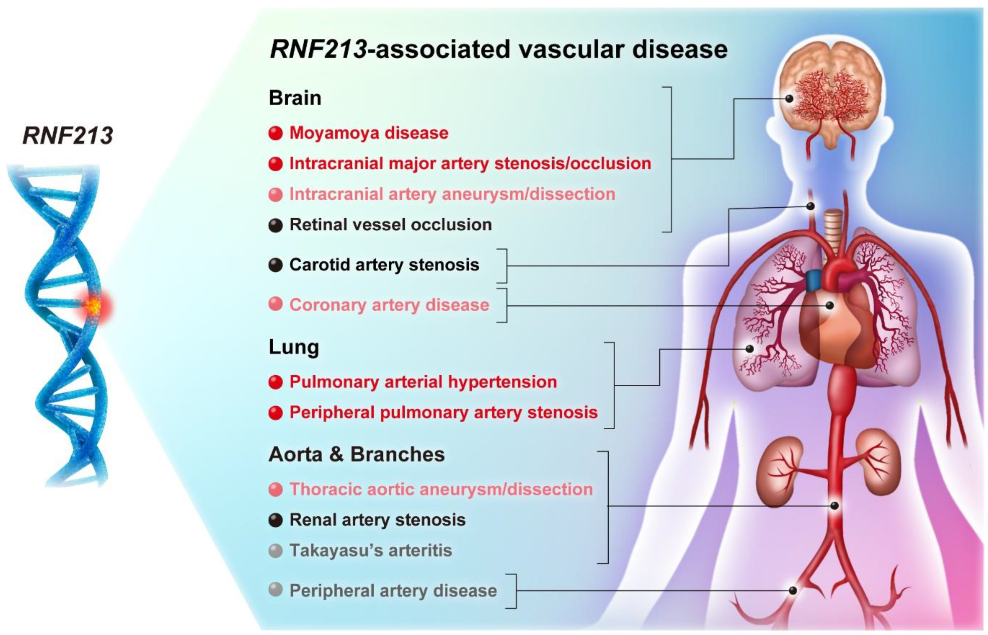 Life | Free Full-Text | RNF213-Associated Vascular Disease: A Concept Unifying Various Vasculopathies