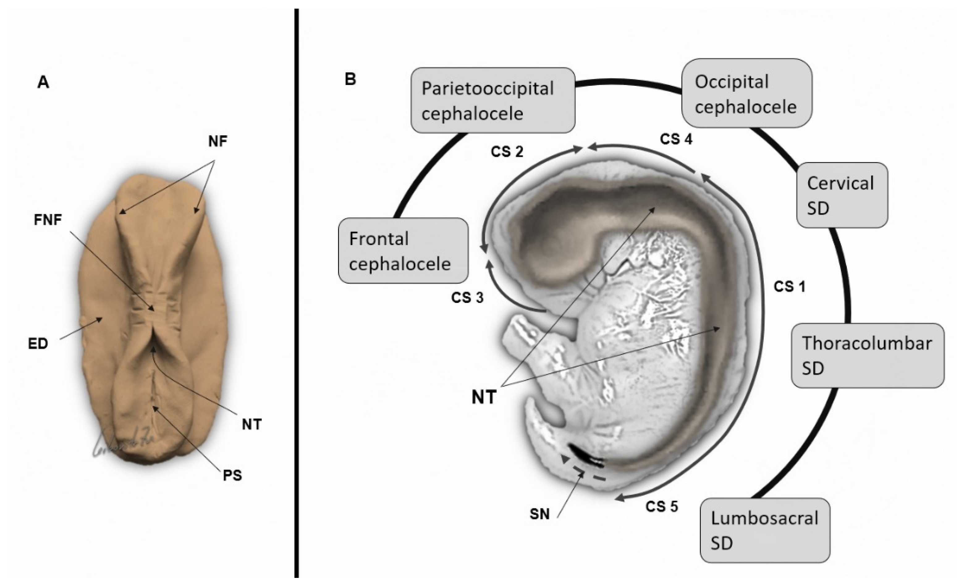 Life Free Full-Text Fetal Brain Development Regulating Processes and Related Malformations image