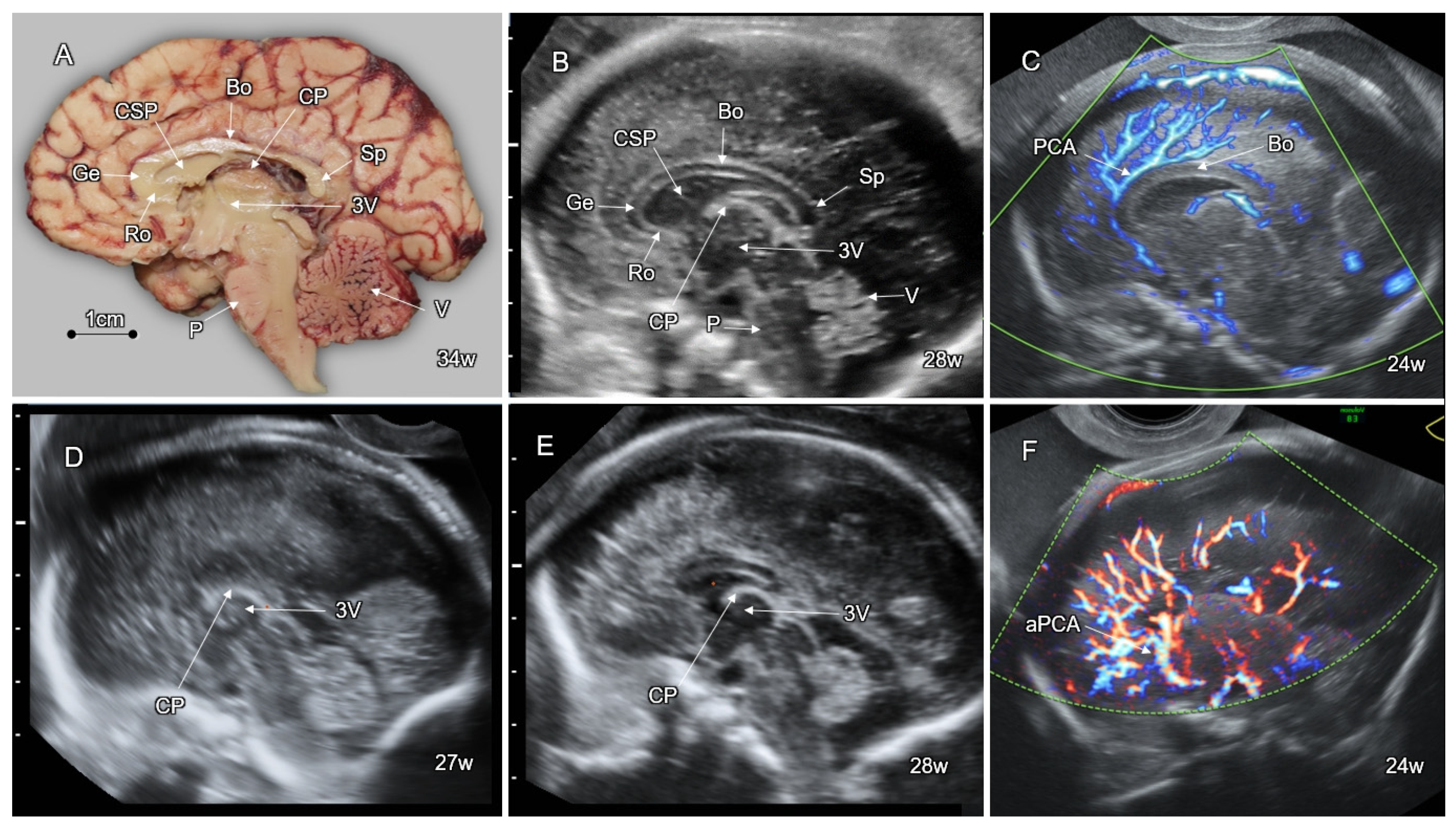 Fetal Brain Development: Regulating Processes and Related