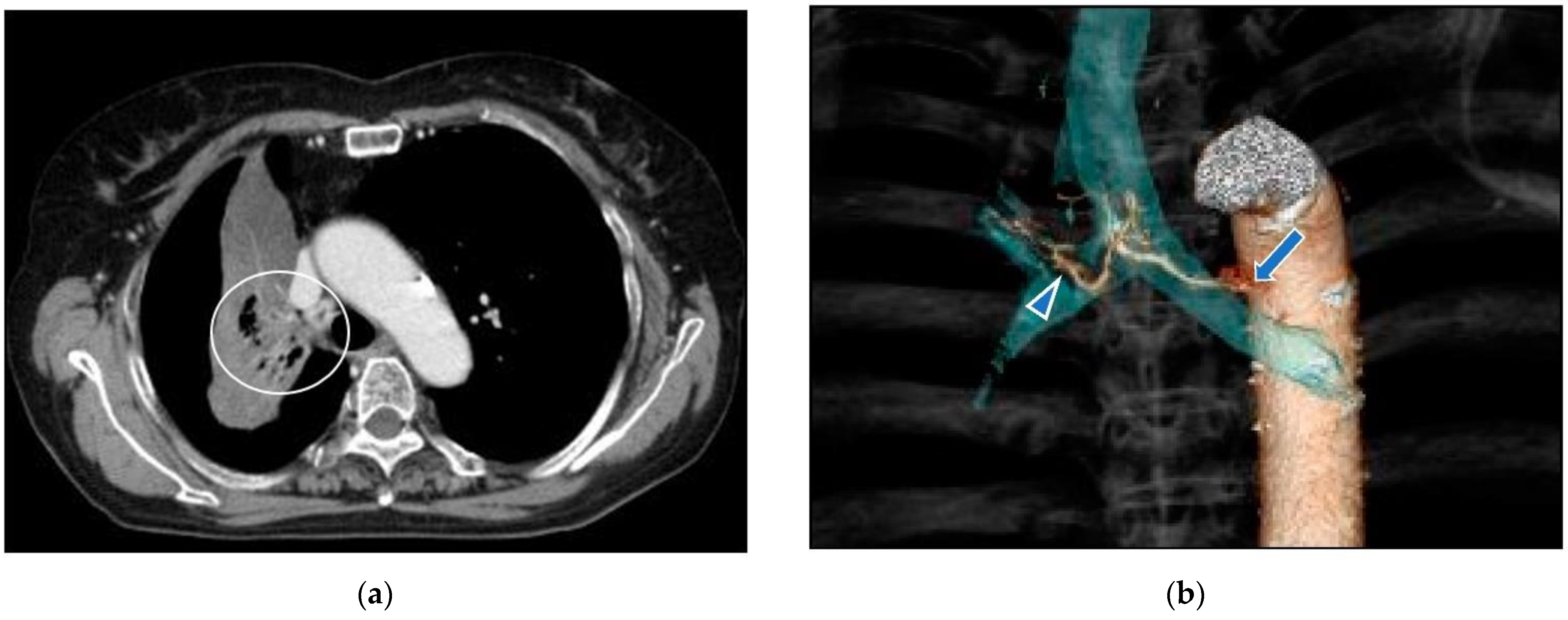Life 12 01078 g011a 550