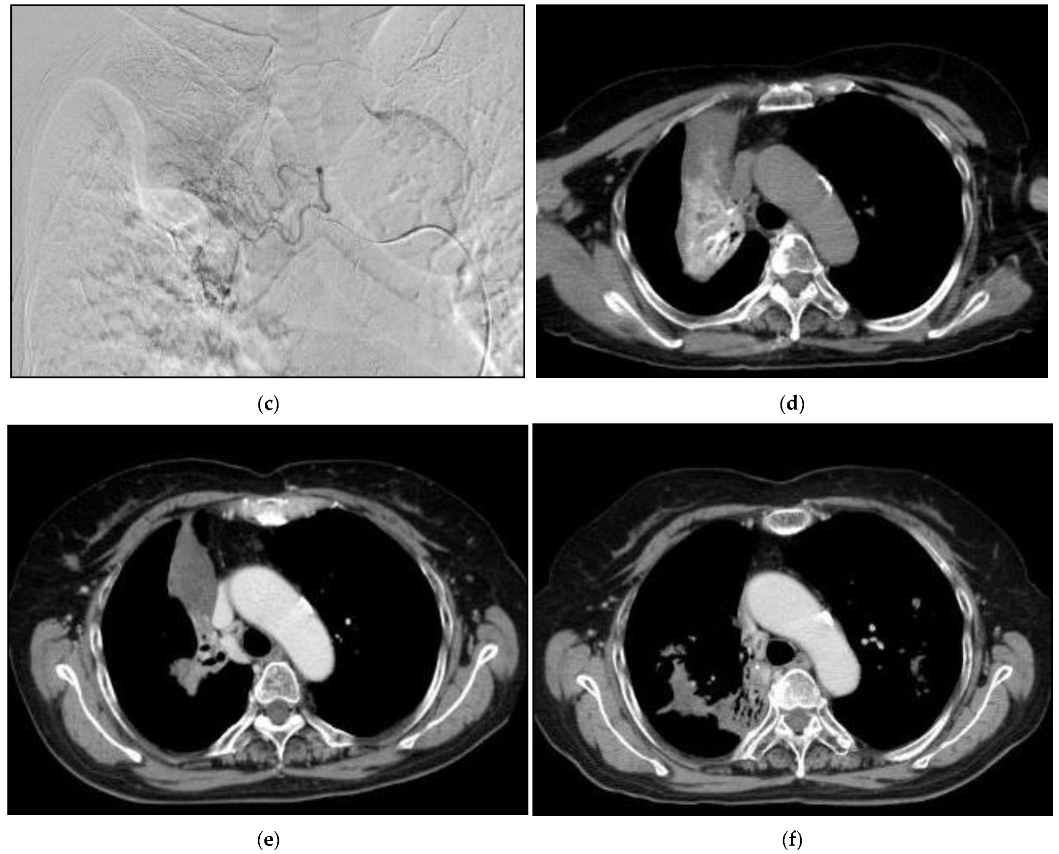 Life 12 01078 g011b 550