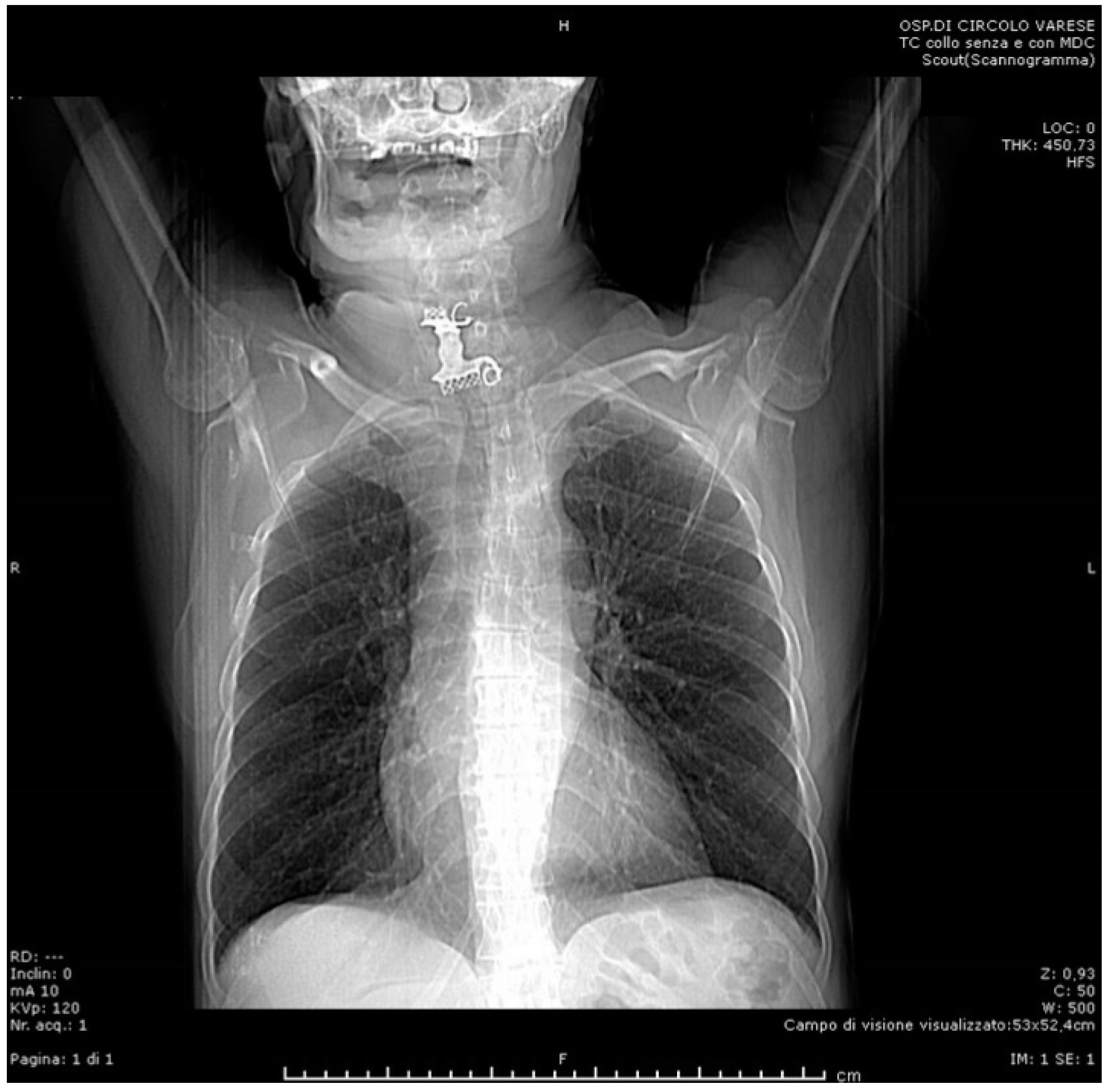 Radiology Quiz 38048 | Radiopaedia.org