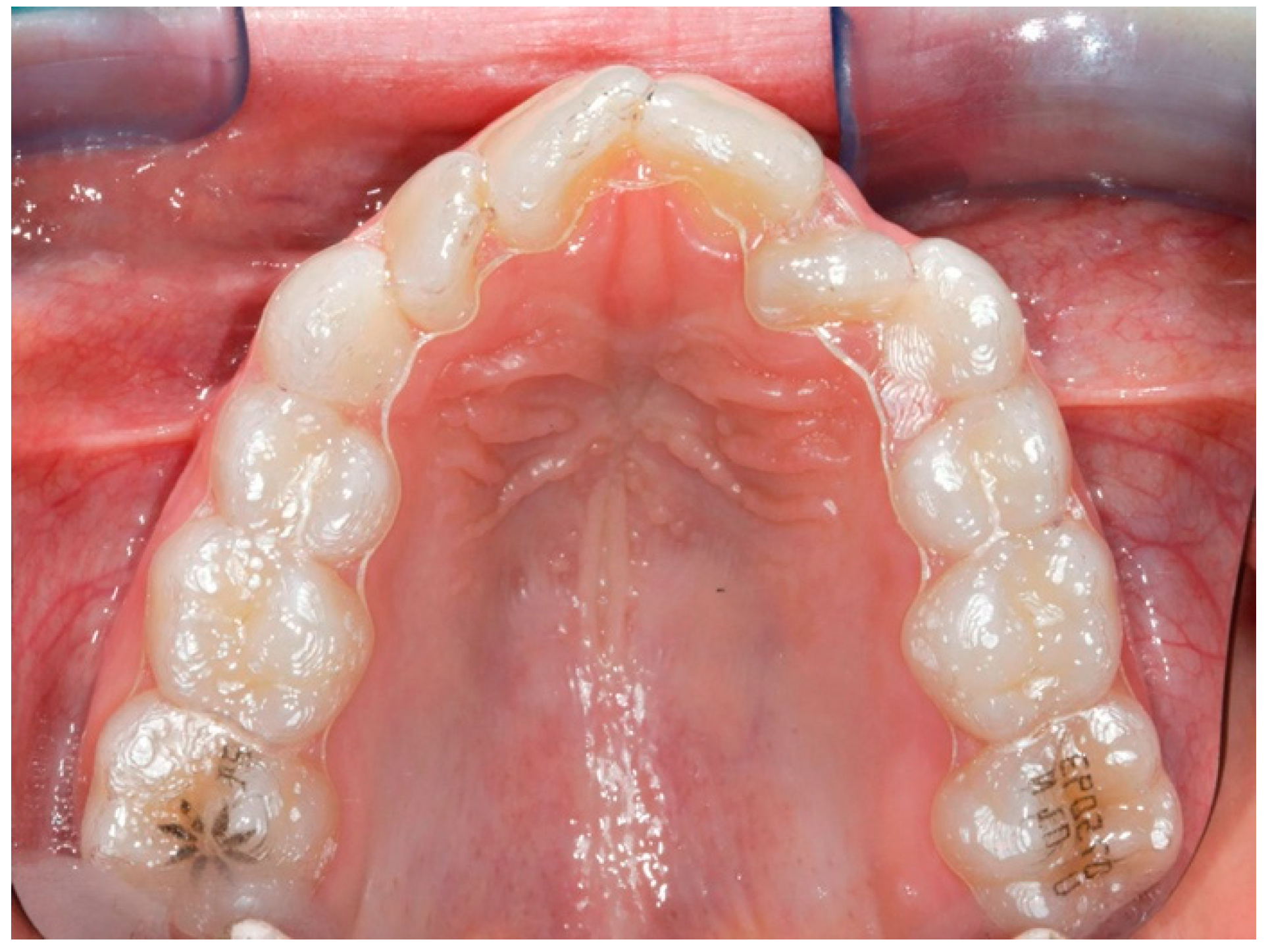 Life | Free Full-Text | Evaluation of the Upper Arch Morphological