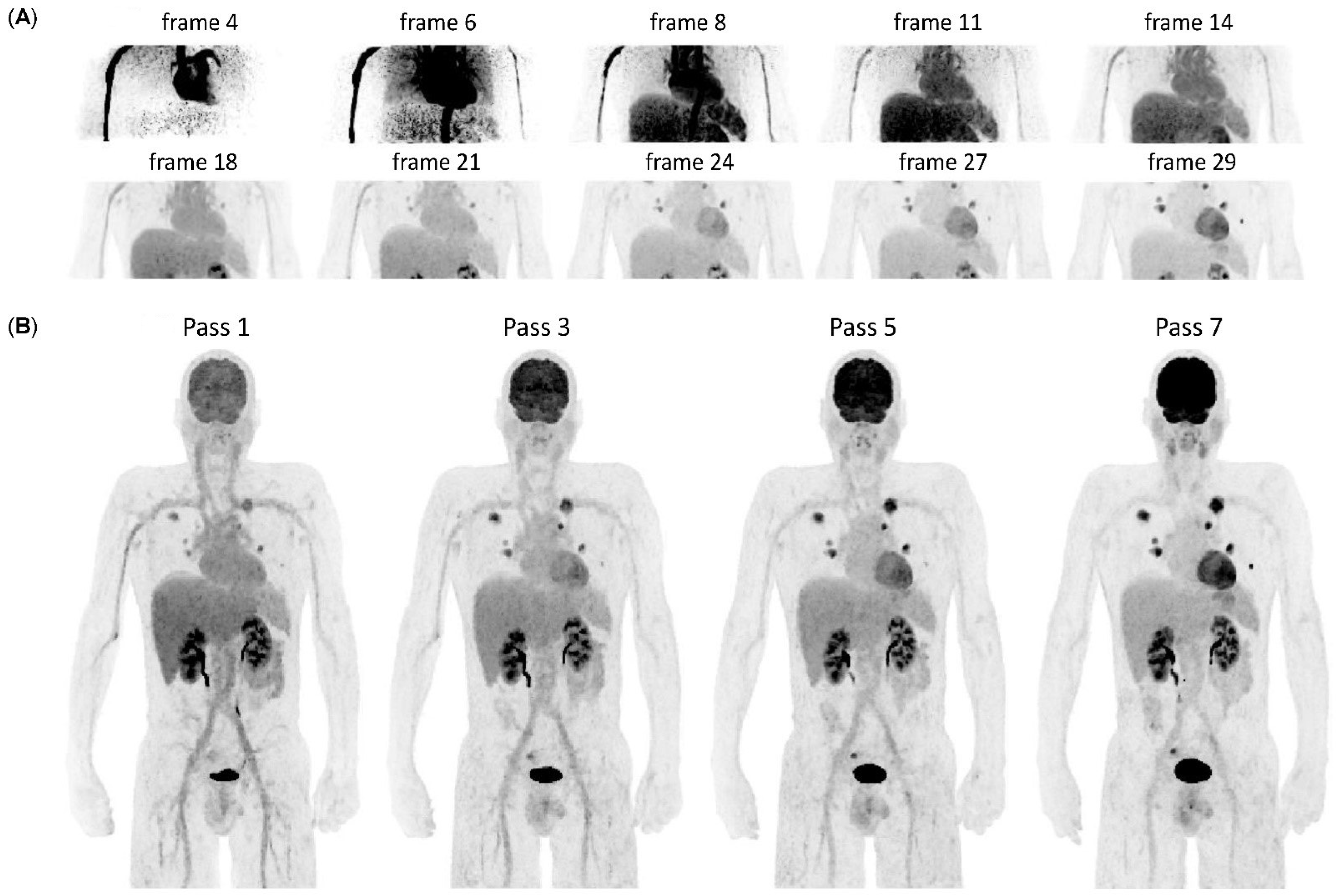 Life Free Full Text Can Dynamic Whole Body FDG PET Imaging life-free-full-text-can-dynamic-whole-body-fdg-pet-imaging