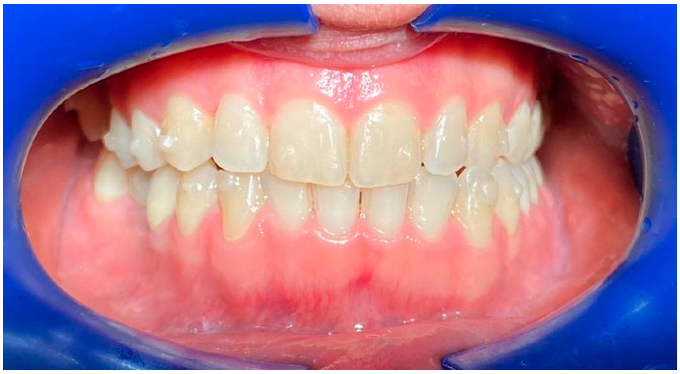 Life Free FullText Clear Aligners and Smart Eye Tracking