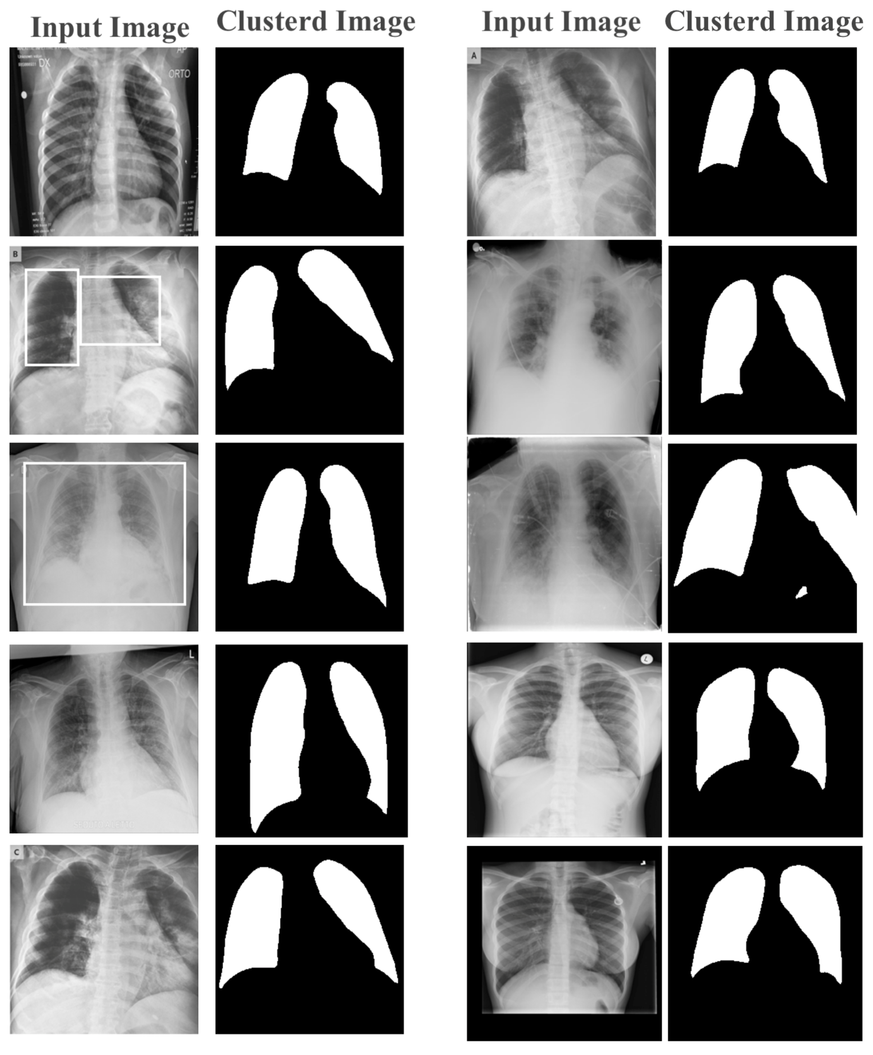 Robust Classification and Detection of Big Medical Data Using Advanced ...
