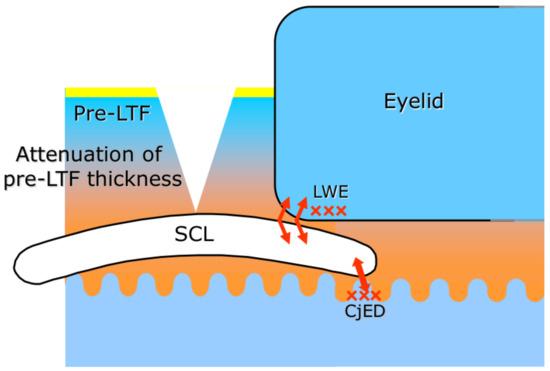 Dynamic Aspects of Pre-Soft Contact Lens Tear Film and Their Relation ...