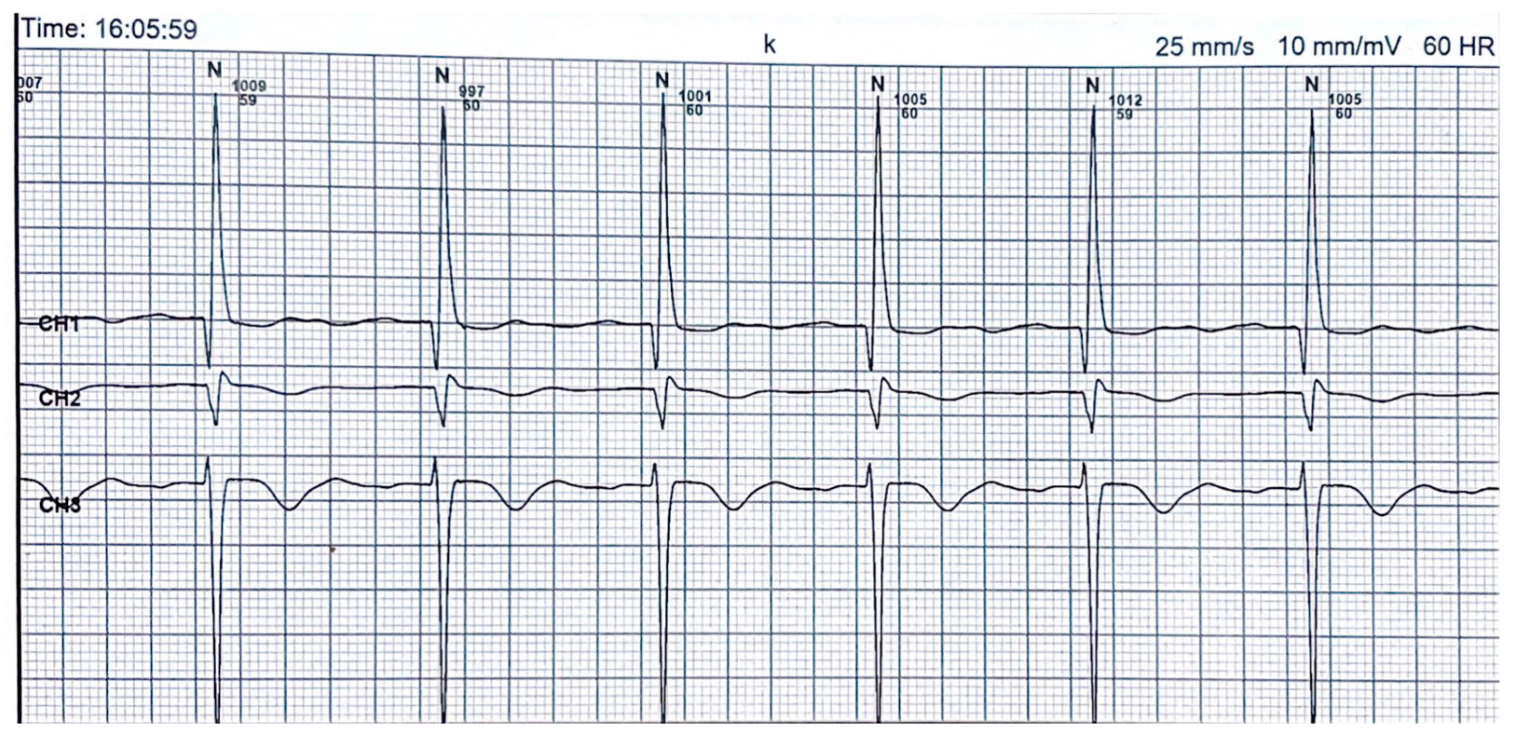24h ECG Holter Monitor £170, London Cardiology Clinics