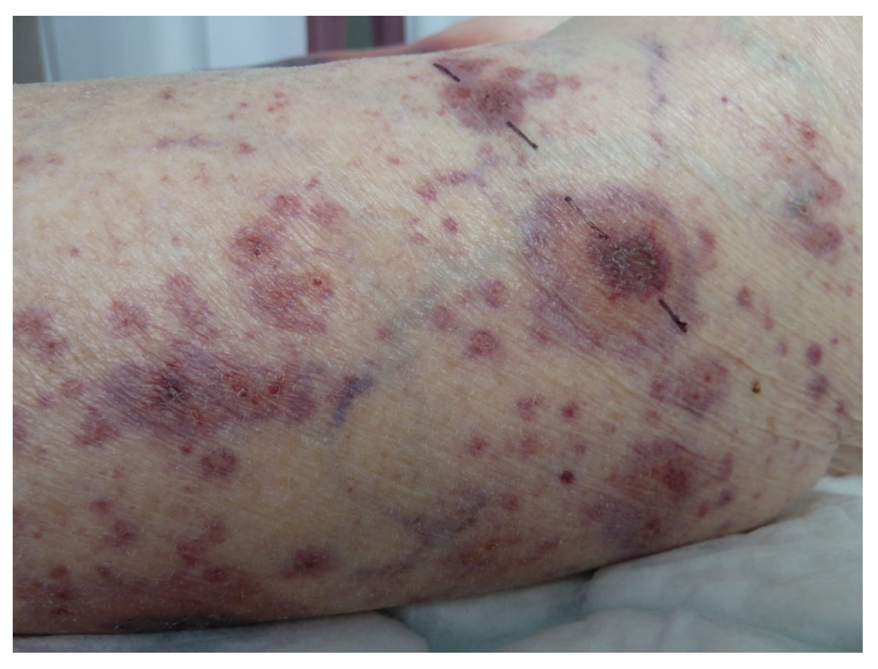 Life 13 01245 g011 Life 13 01245 g011