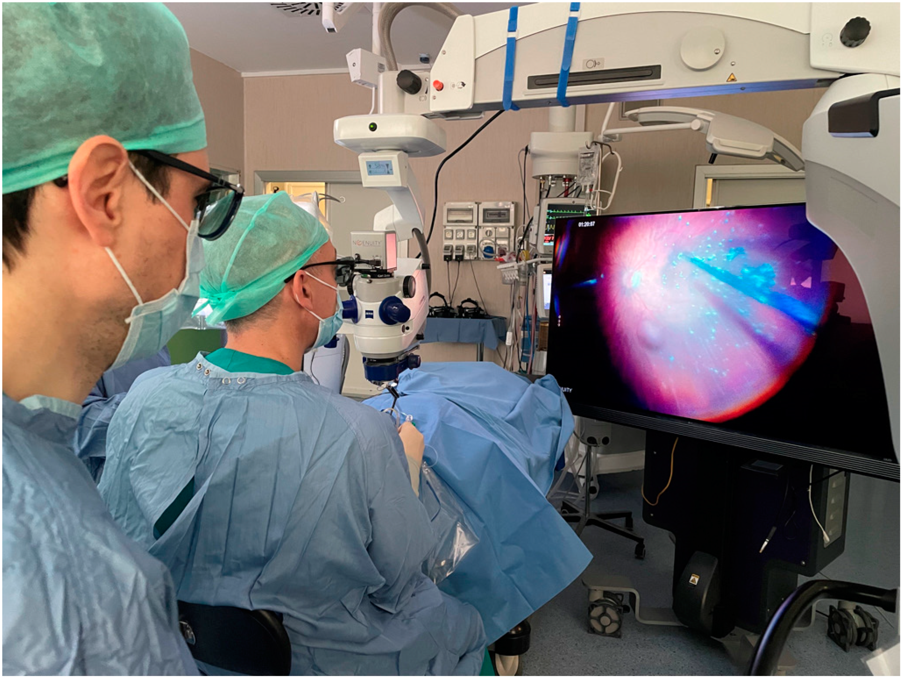Three-Dimensional Visualization System for Vitreoretinal