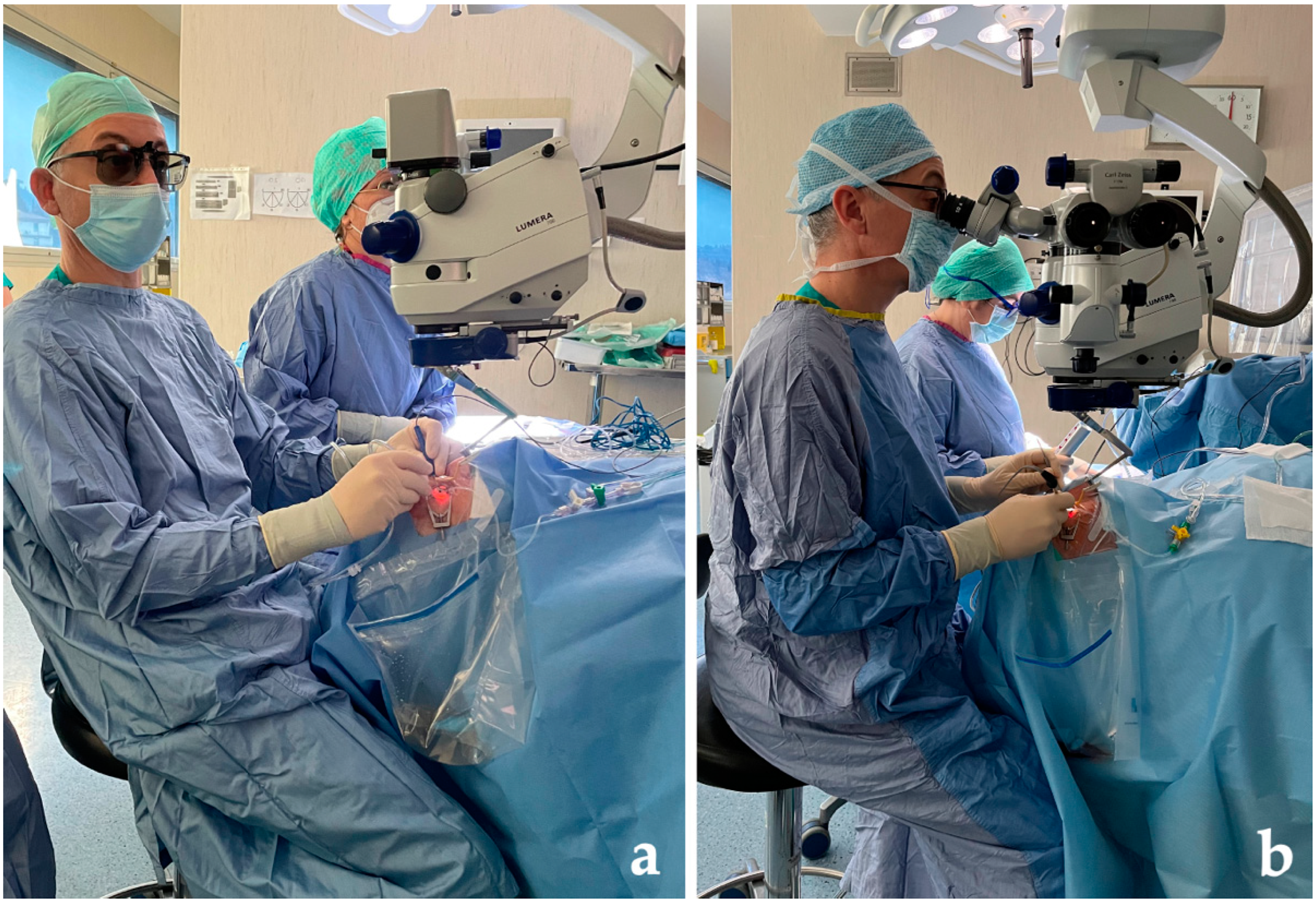 健康・医学 Vitreoretinal Surgery Strategies Tactics Vitreoretinal Surgery: Strategies and Tactics | SpringerLink
