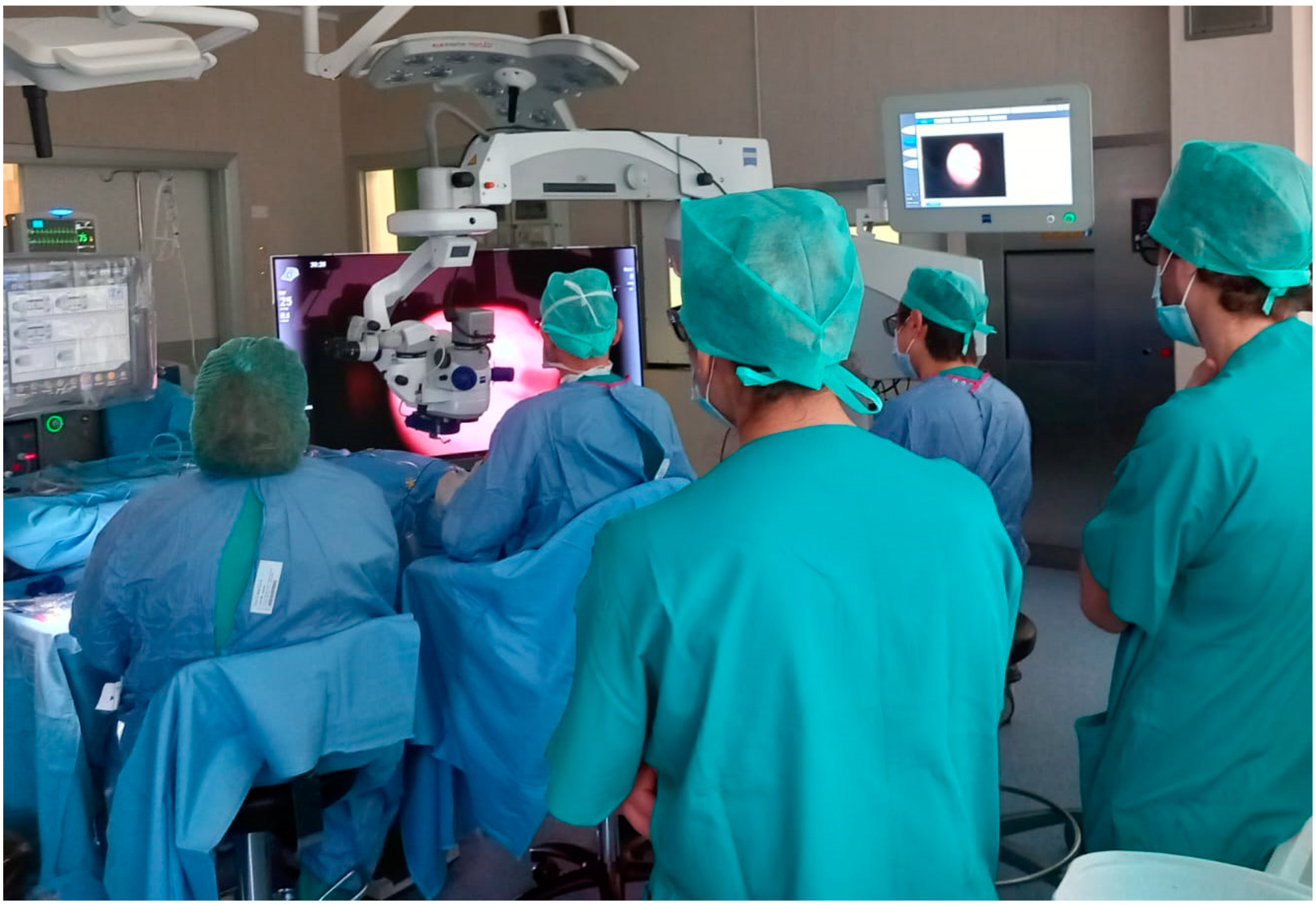 健康・医学 Vitreoretinal Surgery Strategies Tactics Vitreoretinal Surgery | SpringerLink