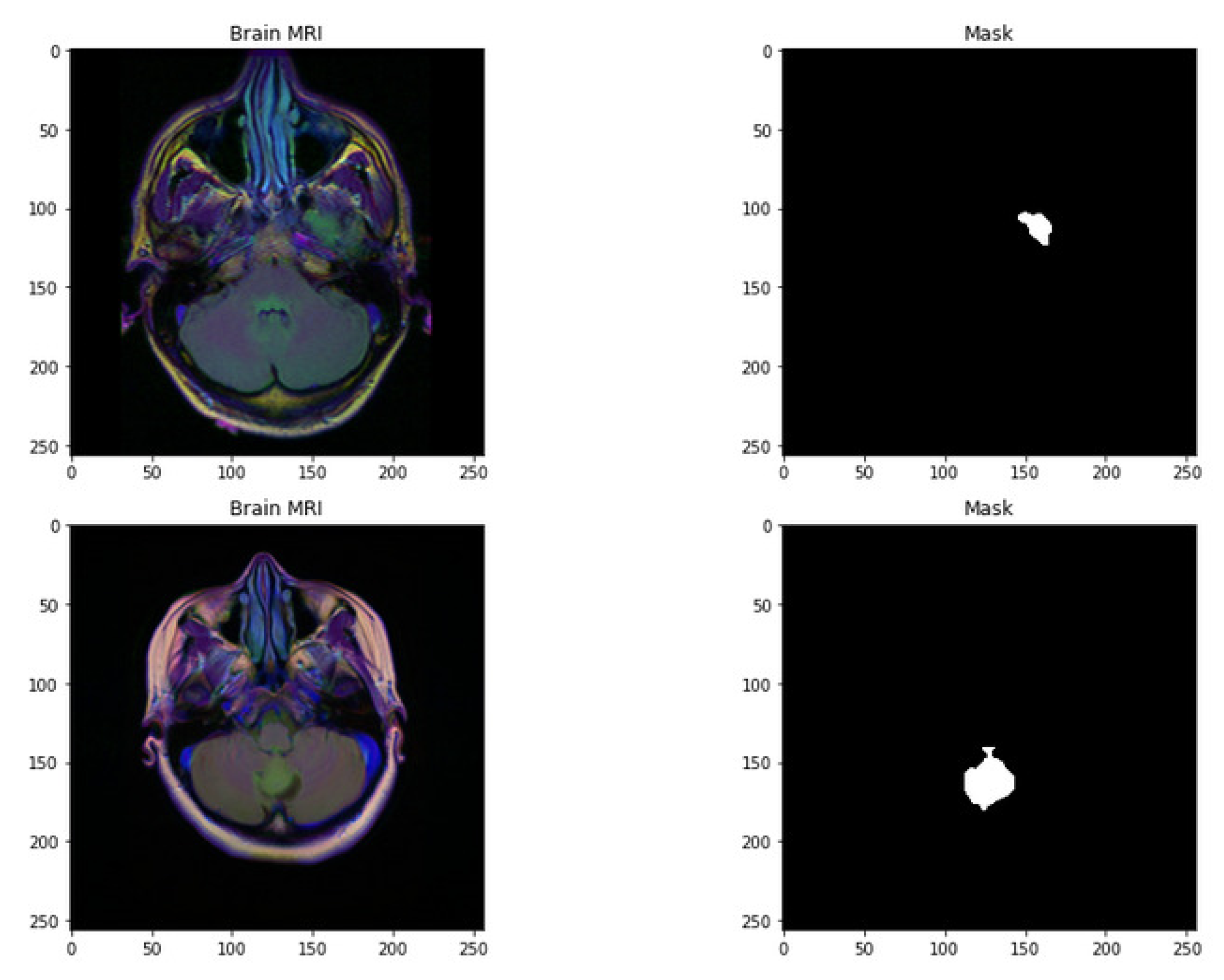 Life free full text brain tumor detection and classification using