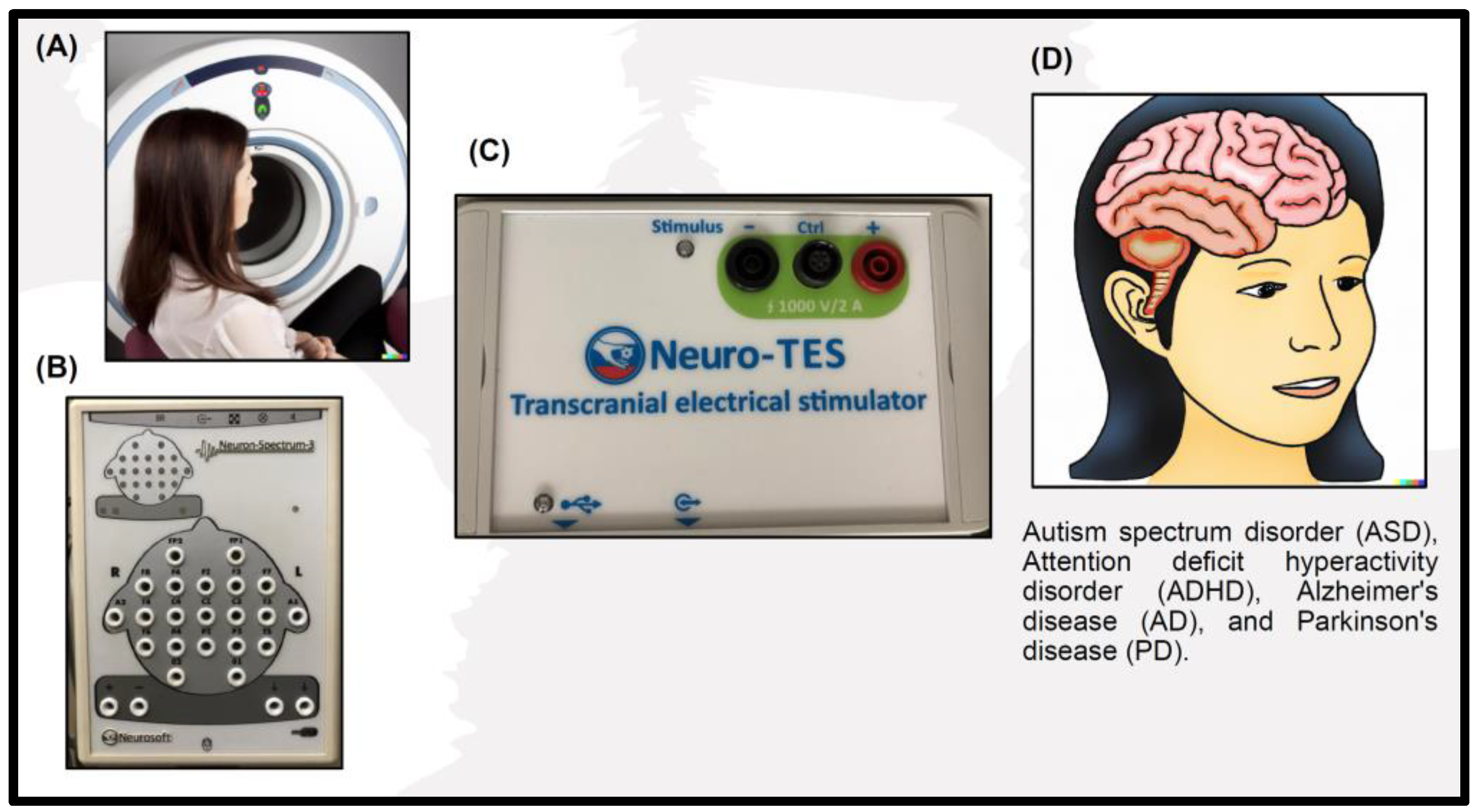 Frontiers  Safety and efficacy of electrical stimulation for