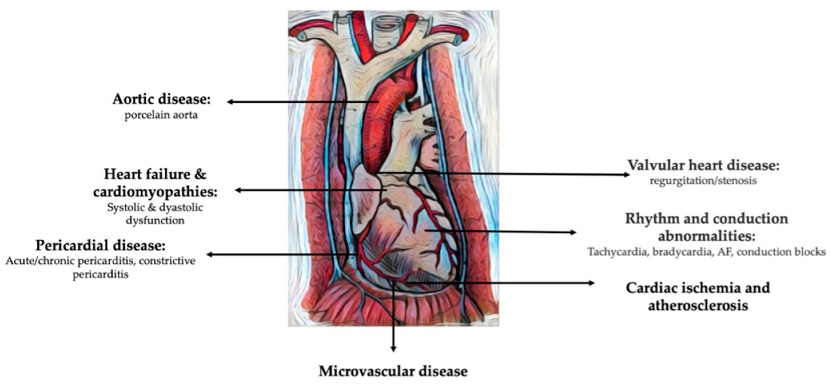 Life Free Full Text Accelerated Atherosclerosis And Cardiovascular life-free-full-text-accelerated-atherosclerosis-and-cardiovascular