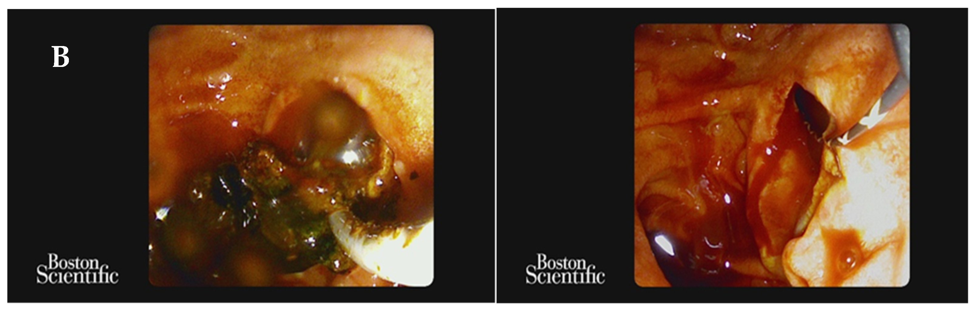 Life 13 01694 g004b Life 13 01694 g004b