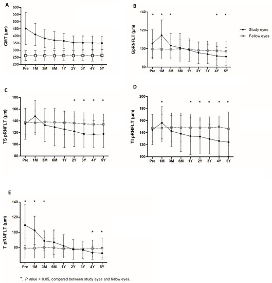 Long-Term Changes in Retinal Nerve Fiber Layer Thickness after ...