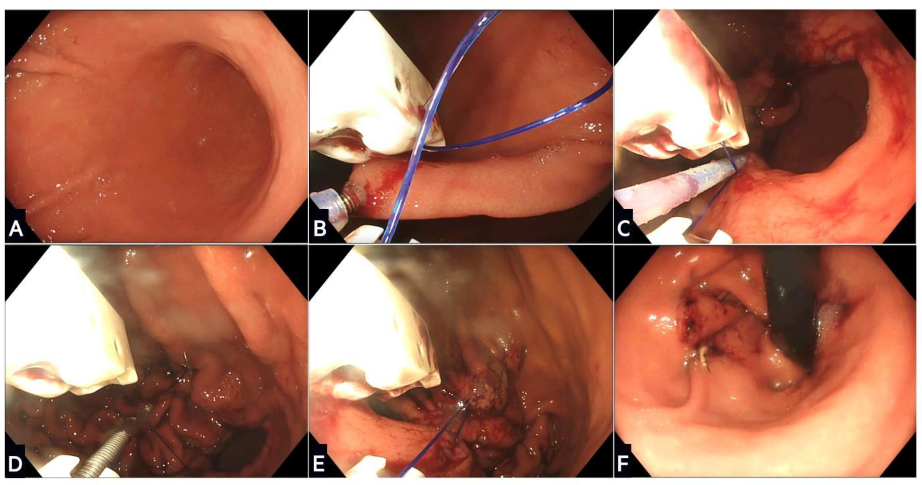 Life 13 01905 g002 Life 13 01905 g002