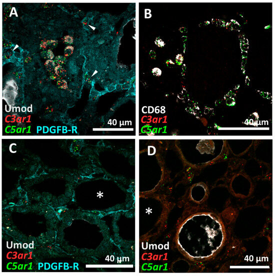 Macrophage-Induced Pro-Fibrotic Gene Expression in Tubular