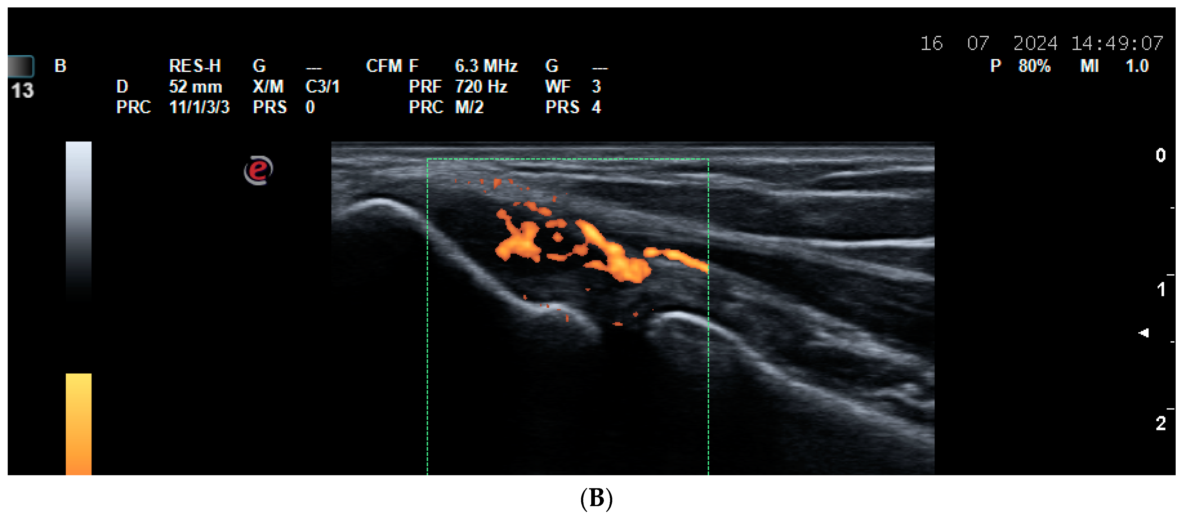 Life 14 01208 g004b Life 14 01208 g004b