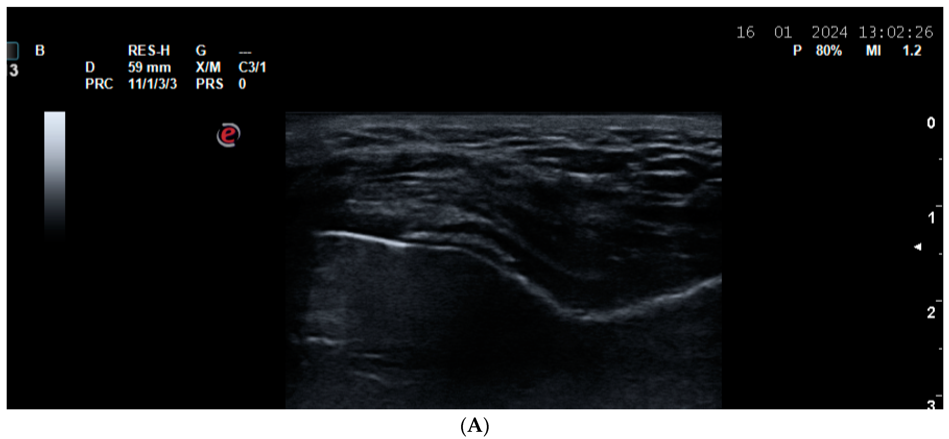 Life 14 01208 g007a Life 14 01208 g007a