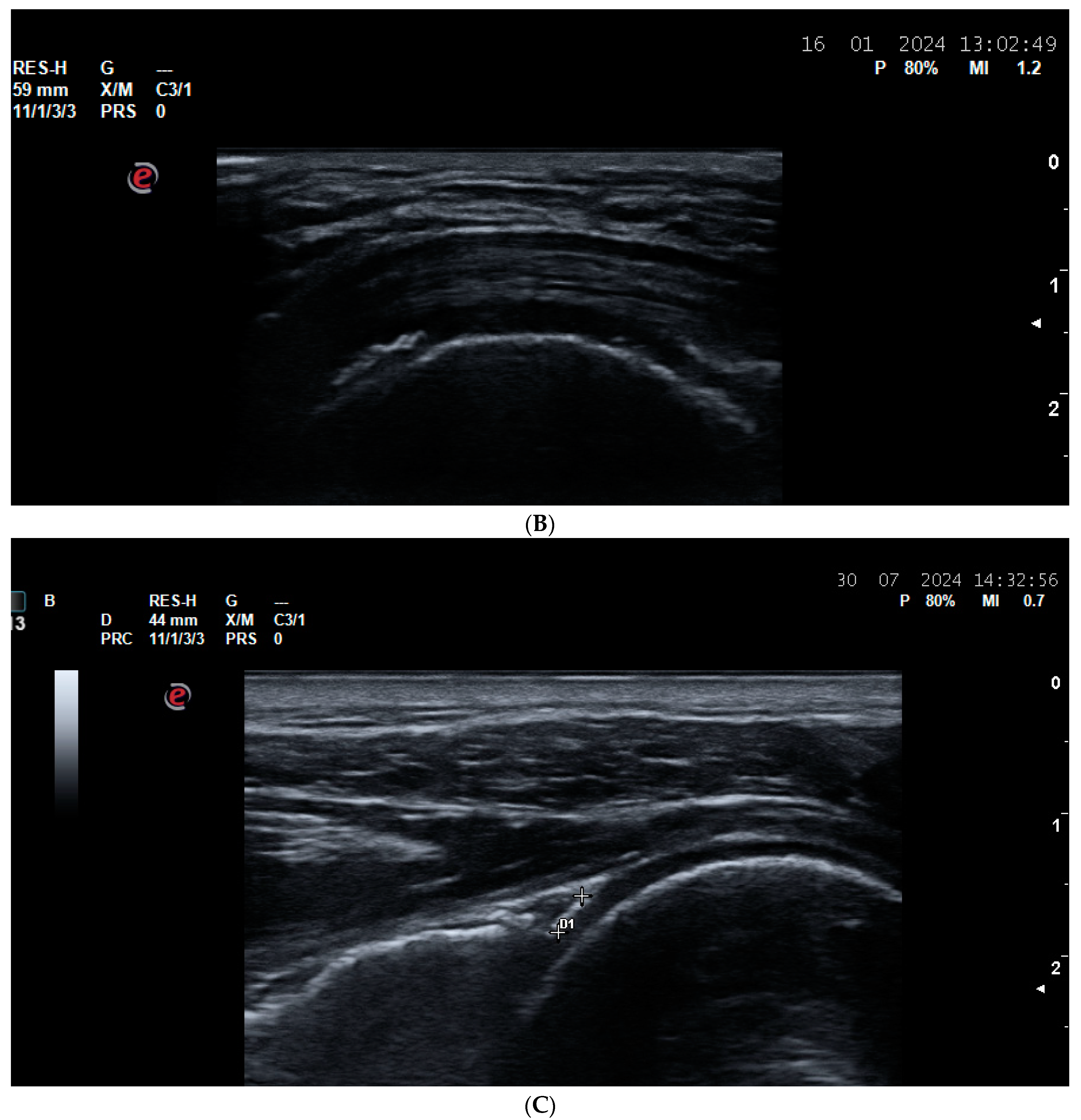 Life 14 01208 g007b Life 14 01208 g007b