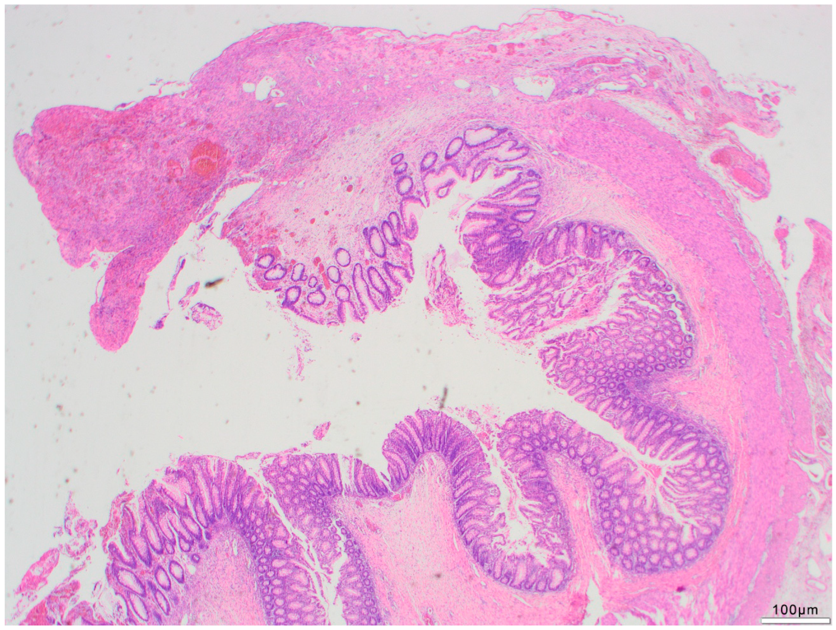 Fresh Hemorrhages in Intestinal Resection Margins Are Fresh Hemorrhages in Intestinal Resection Margins Are
