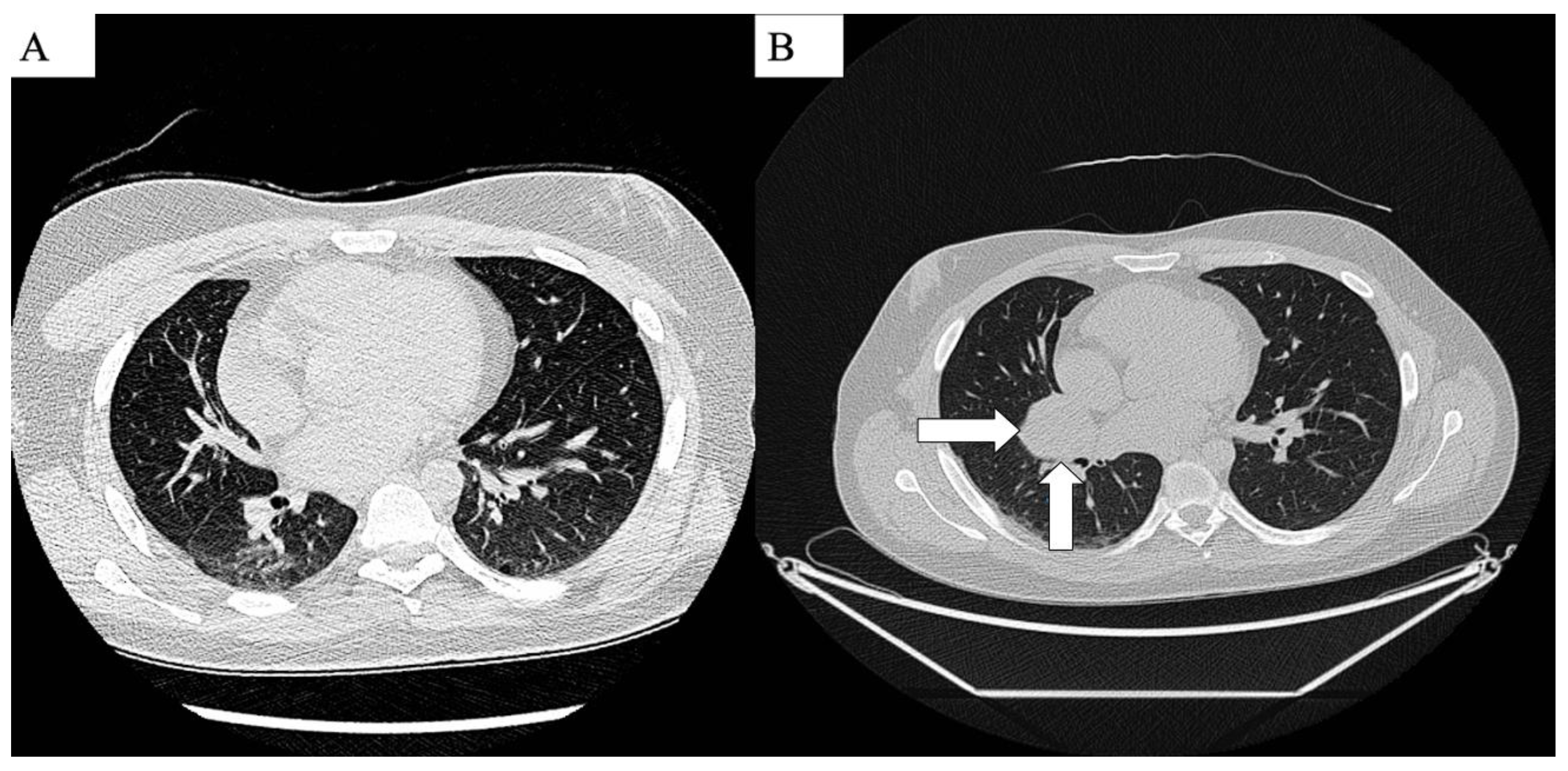 Life 14 01648 g003 Life 14 01648 g003