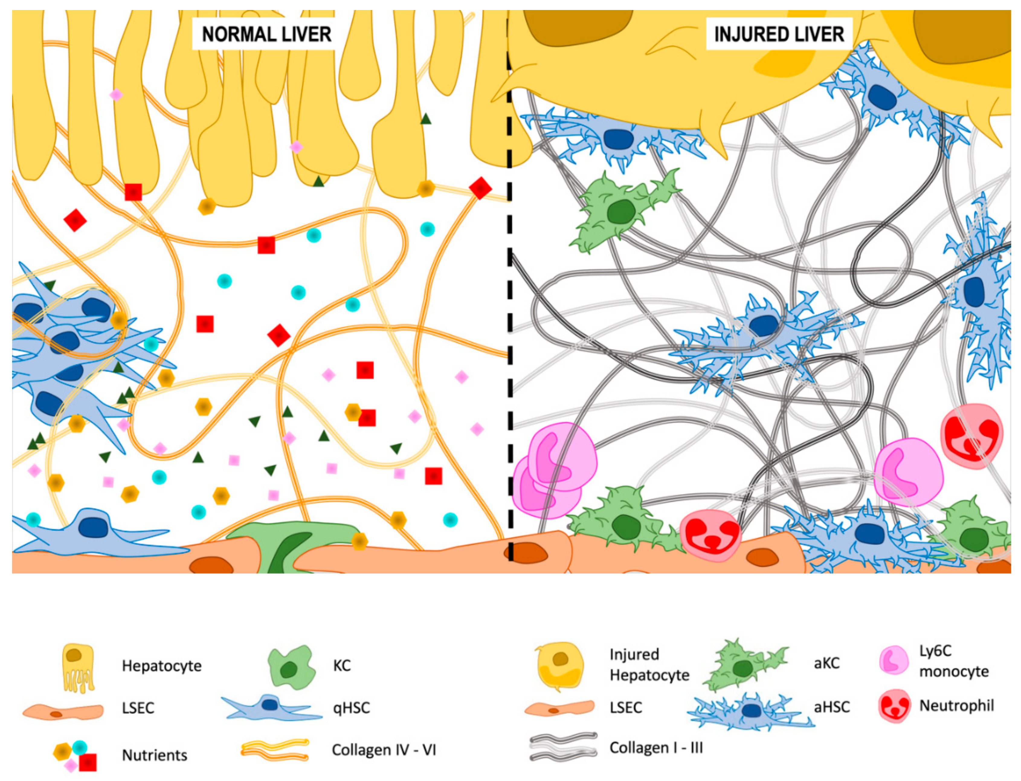 Livers | Free Full-Text | The Space of Disse: The Liver Hub in Health and  Disease