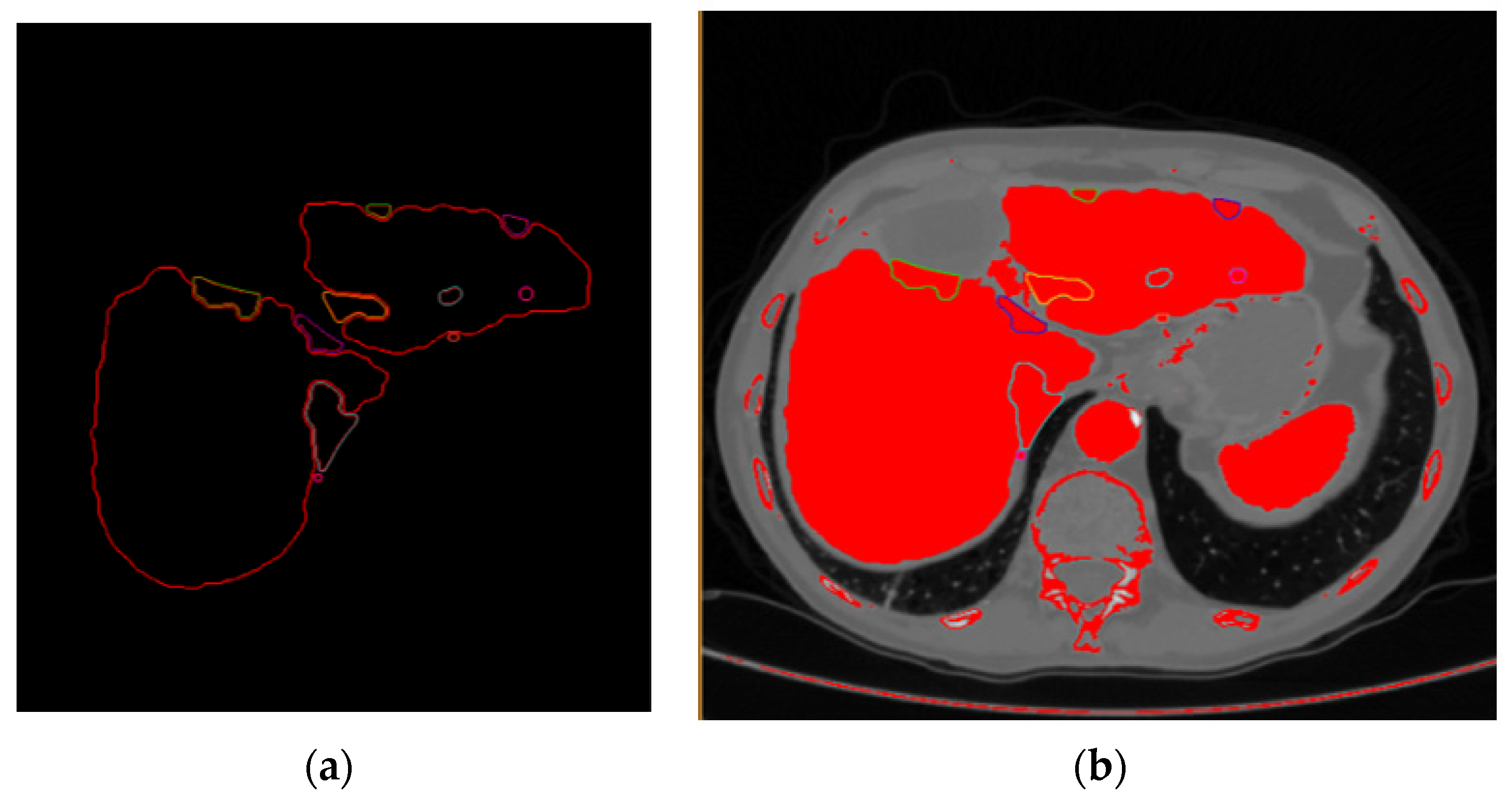 Livers 01 00013 g002 550