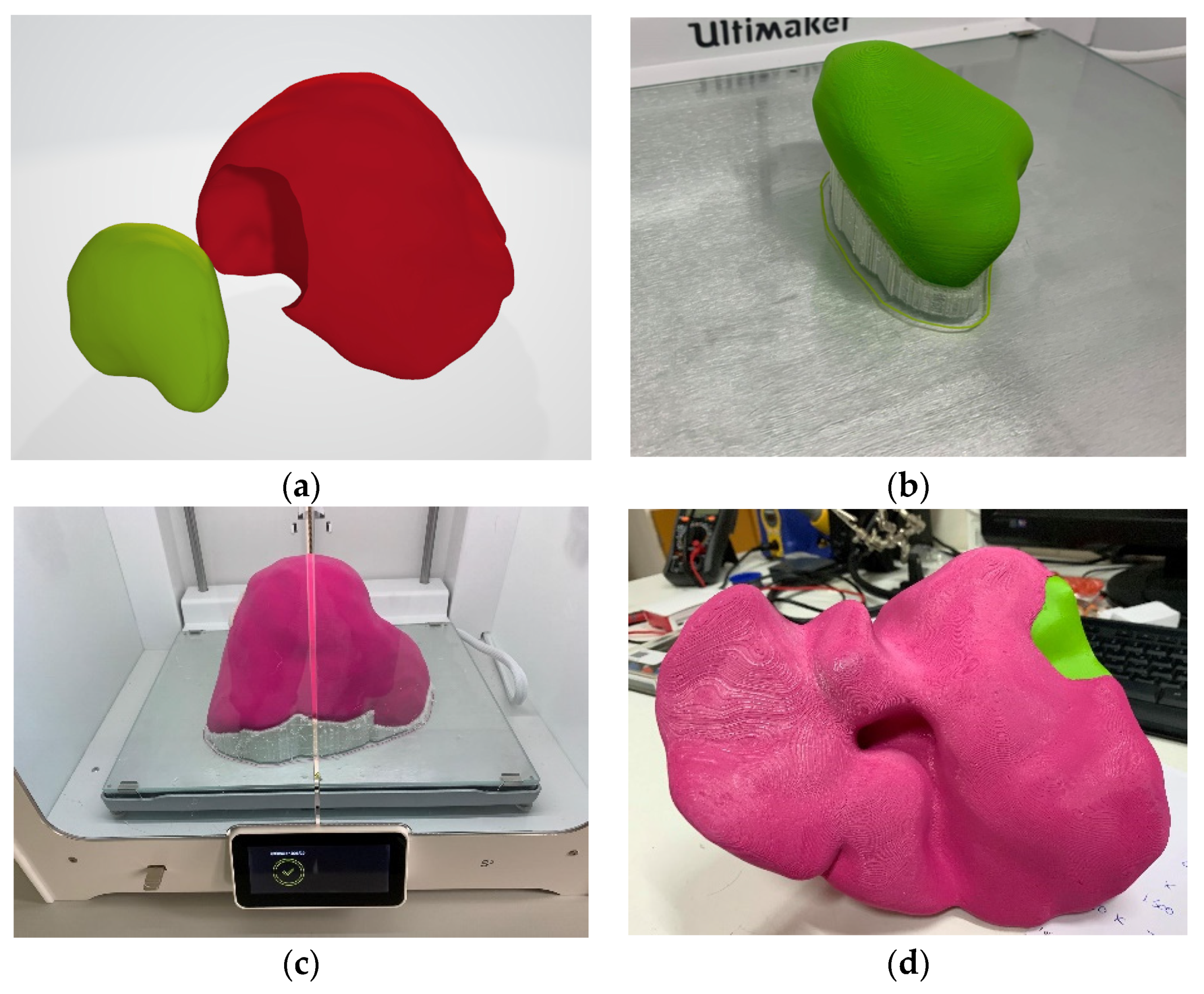 Livers 01 00013 g004 550