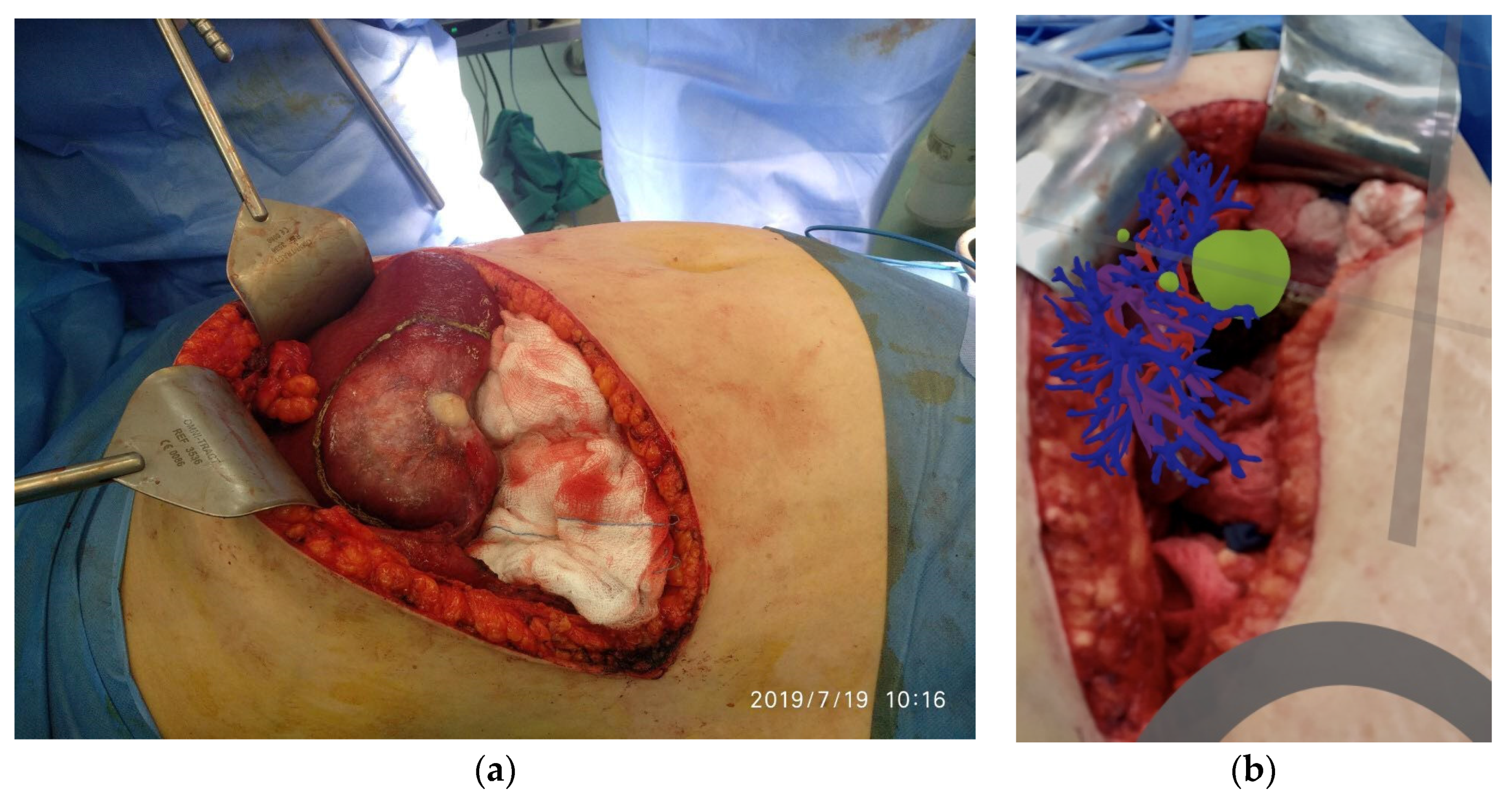 Livers 01 00013 g005 550