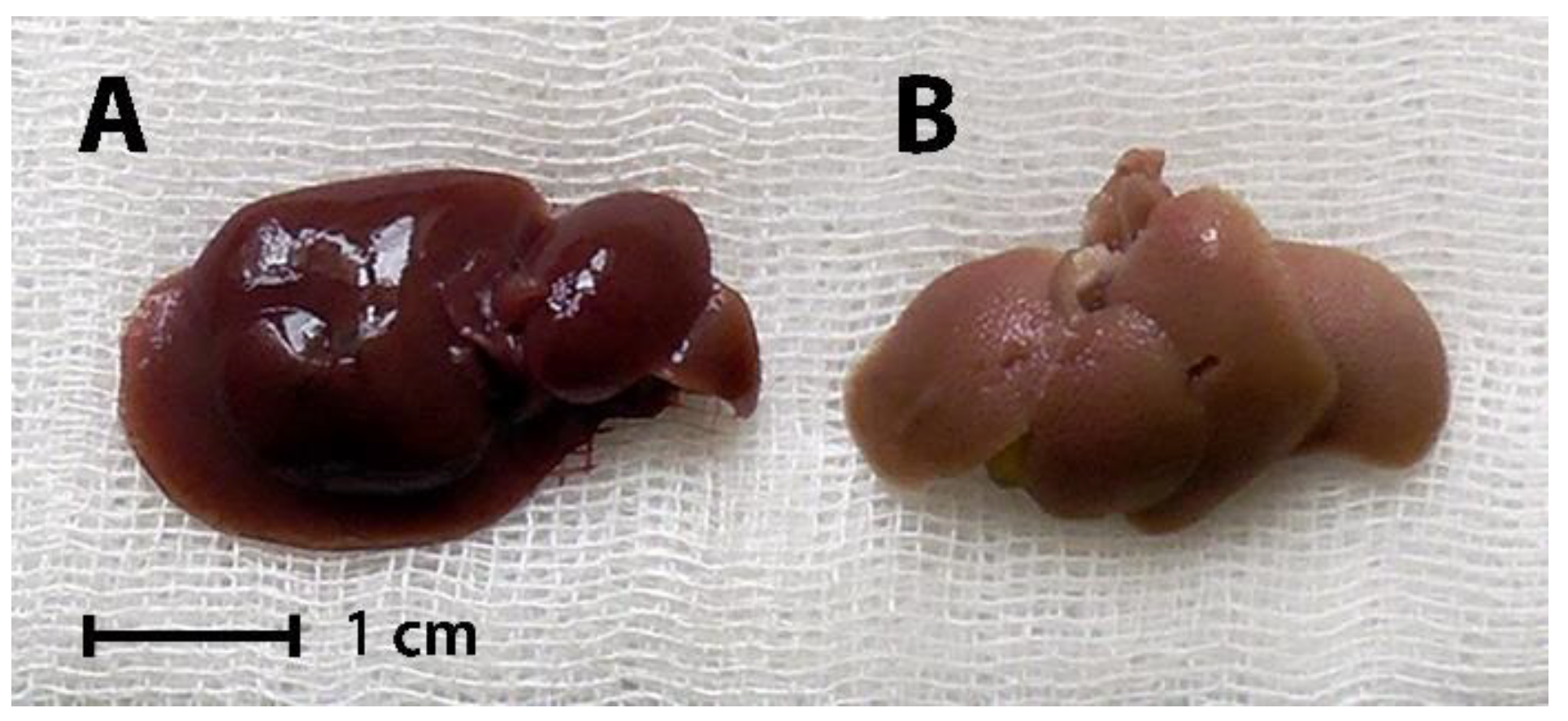 Livers 02 00031 g002