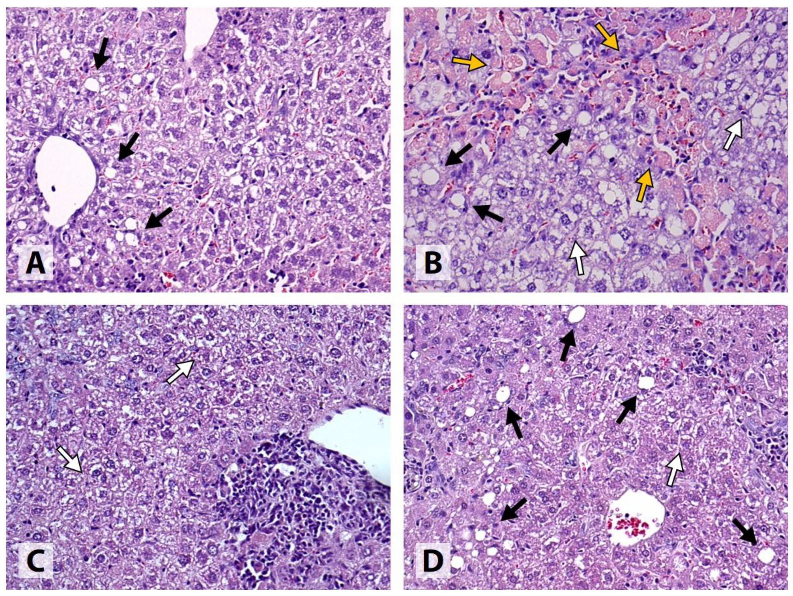 Livers 02 00031 g003