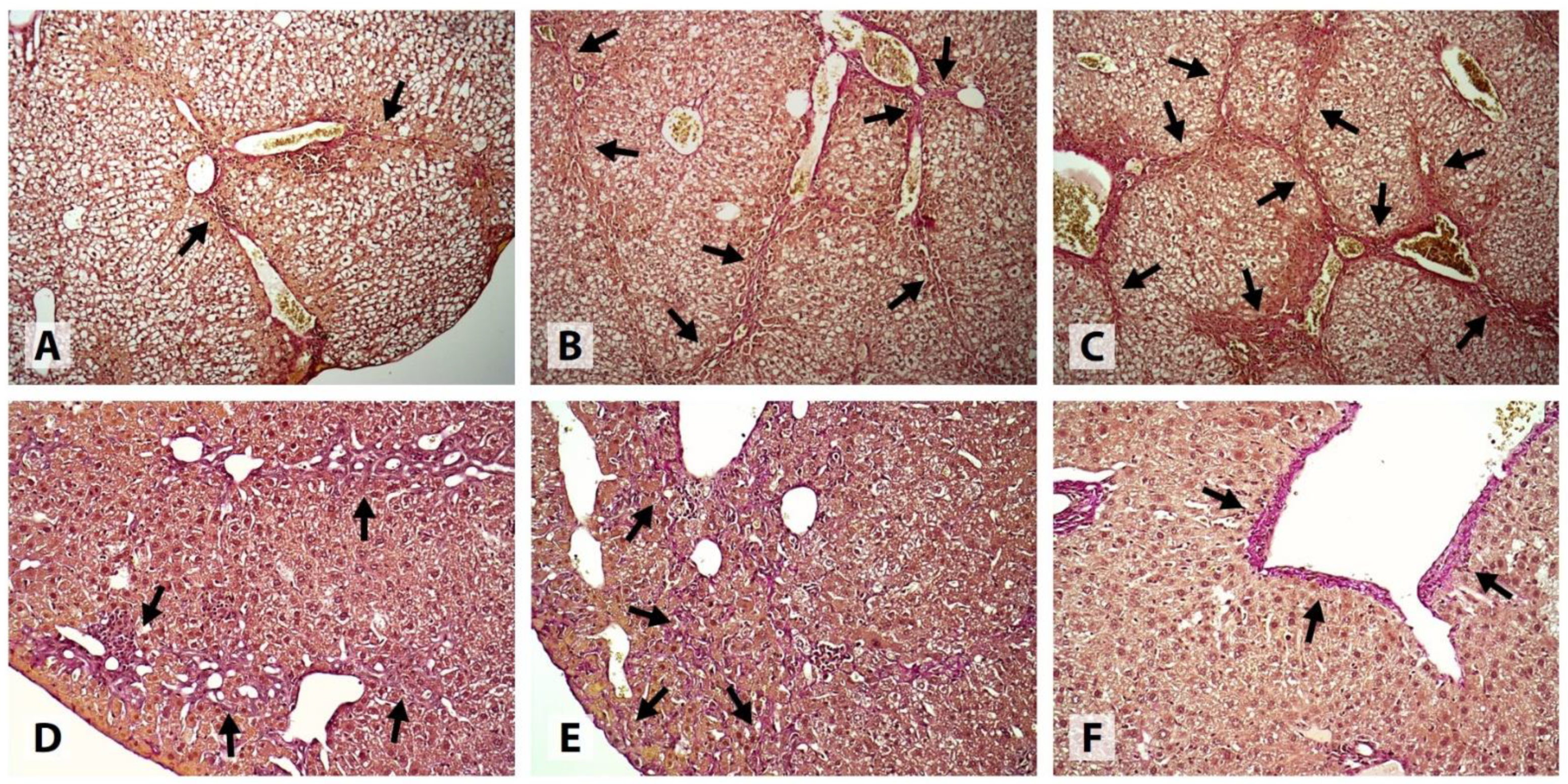 Livers 02 00031 g004