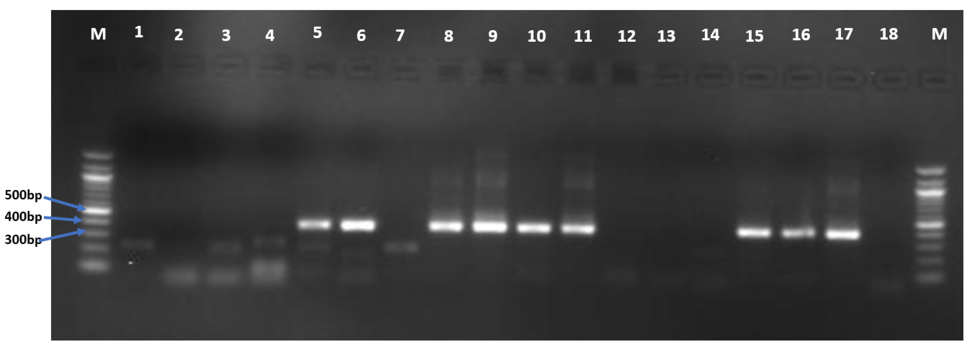 Livers 03 00037 g003 Livers 03 00037 g003