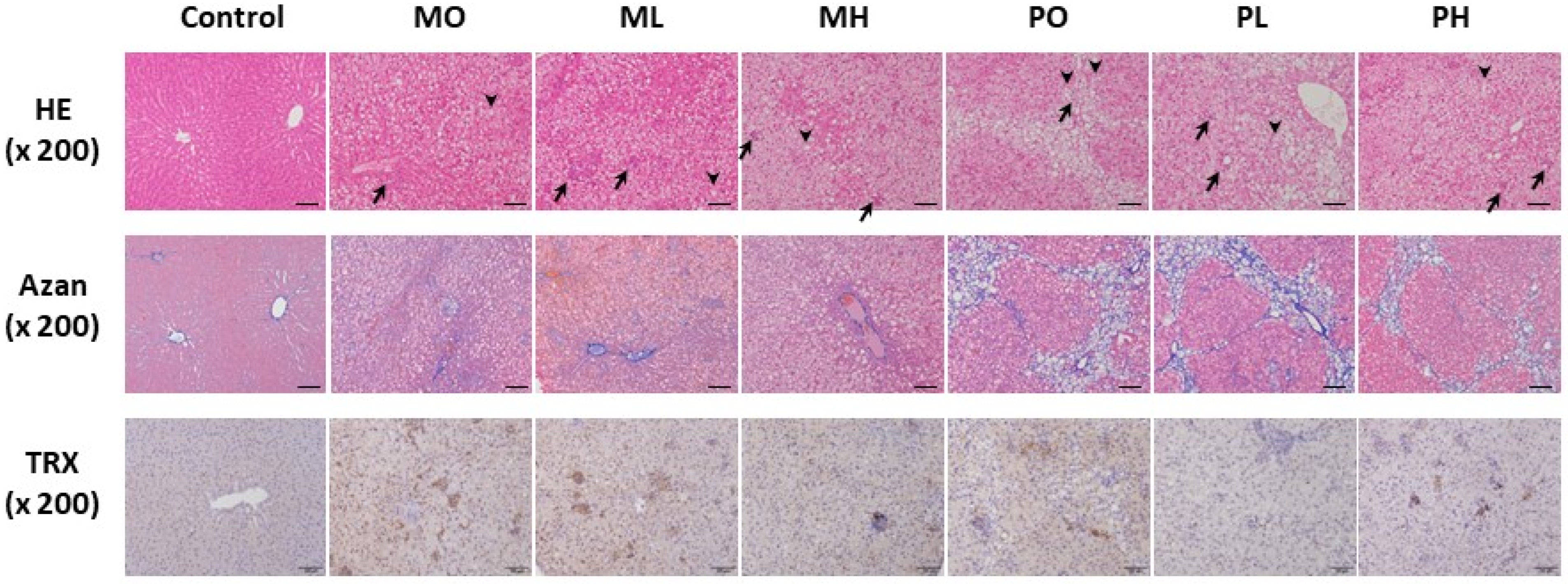 Livers 04 00015 g003
