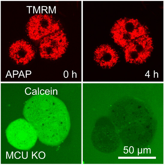 Role of Mitochondrial Iron Uptake in Acetaminophen