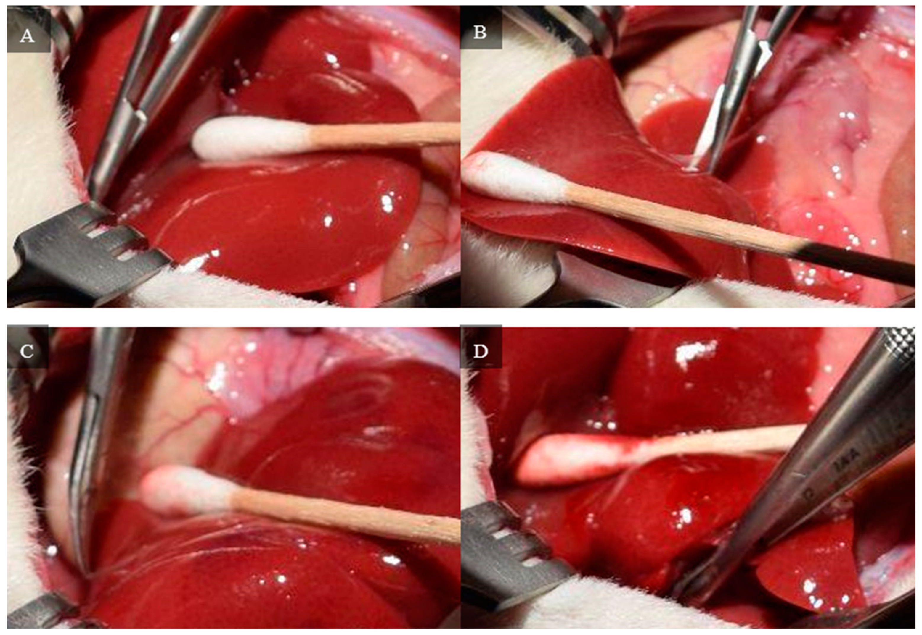 Livers 04 00037 g003