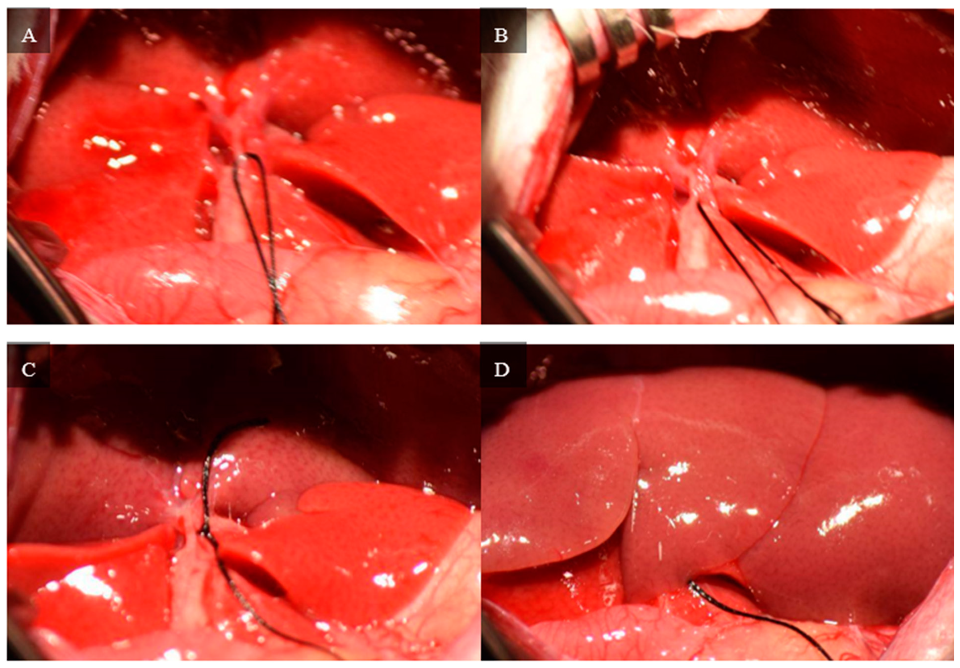 Livers 04 00037 g005