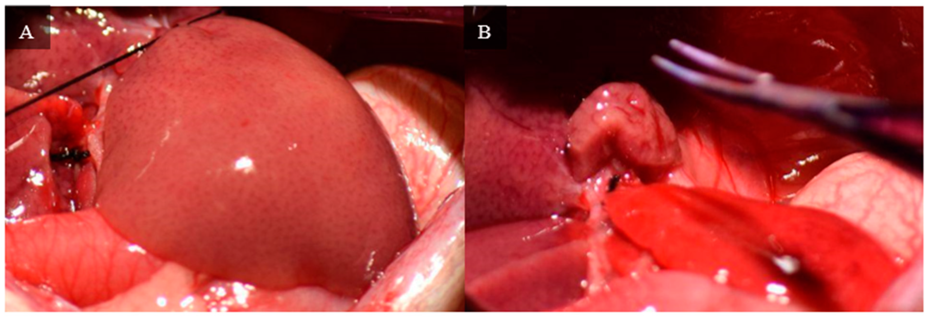 Livers 04 00037 g007