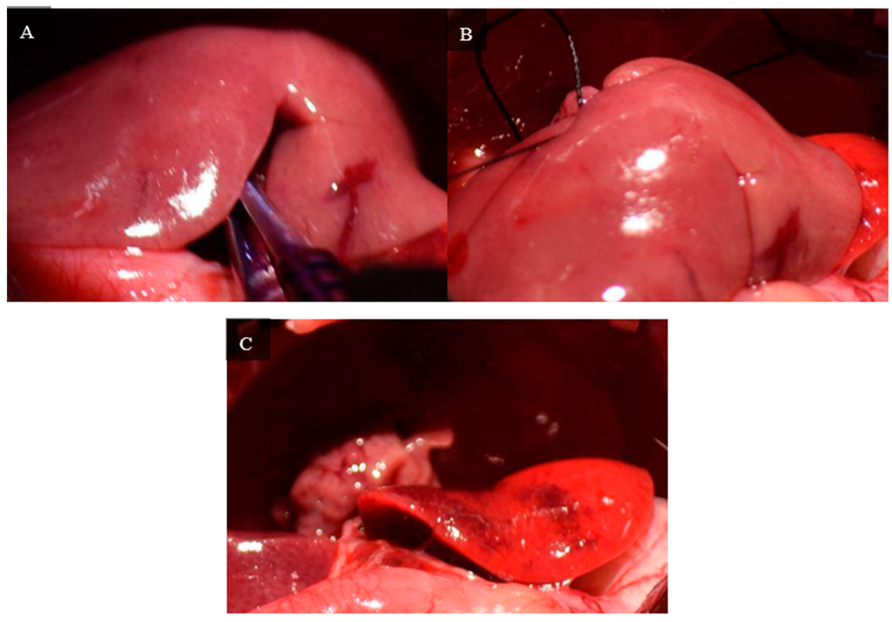 Livers 04 00037 g008