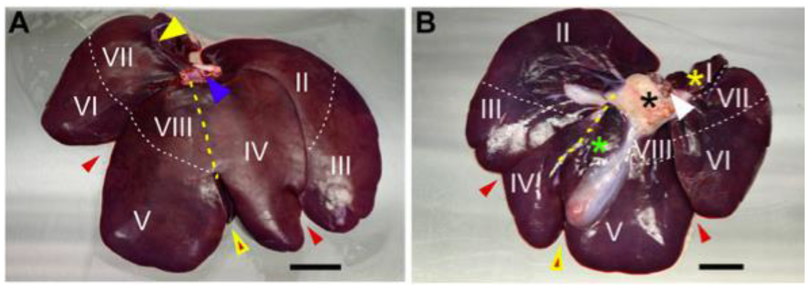 Livers 05 00003 g002