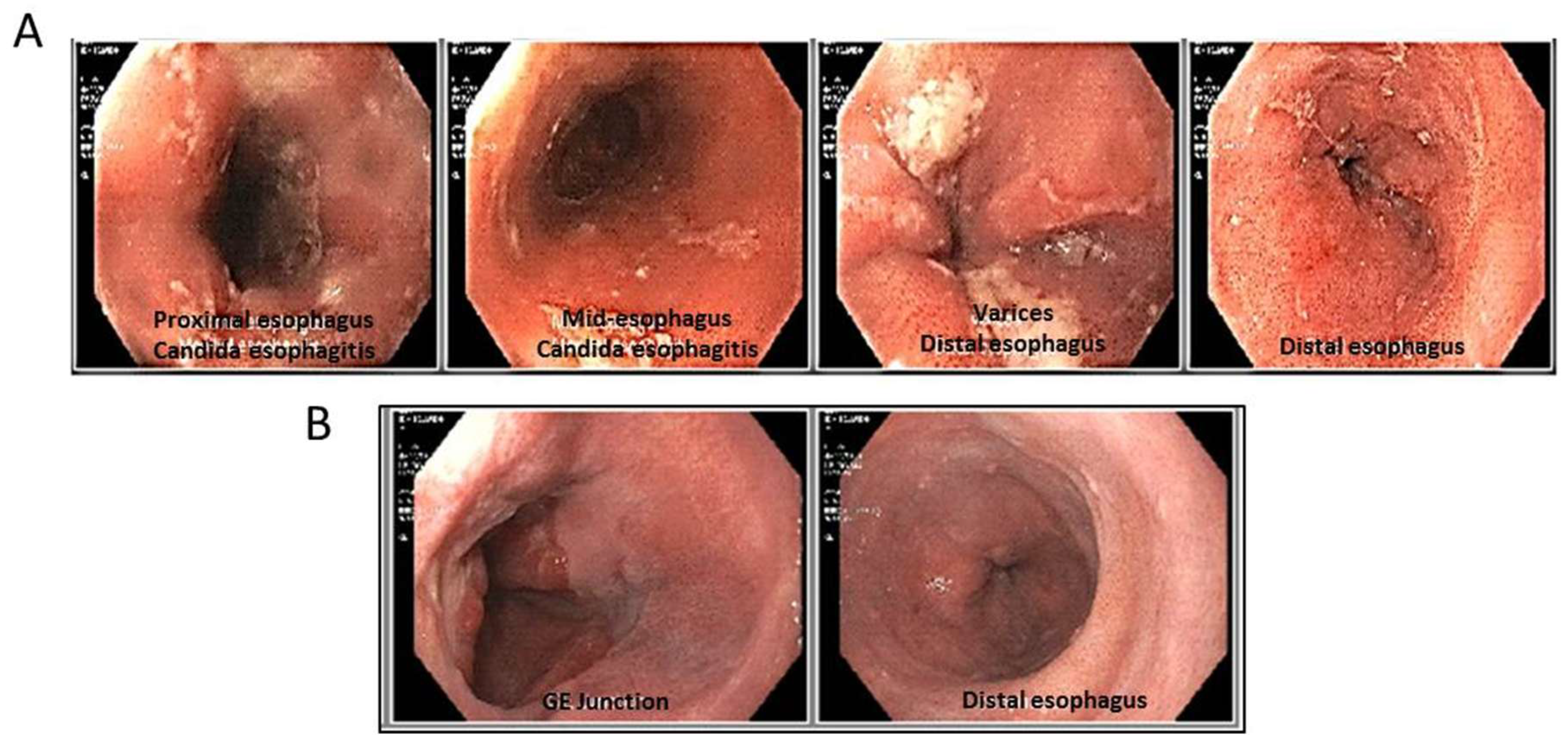 Livers 05 00013 g001