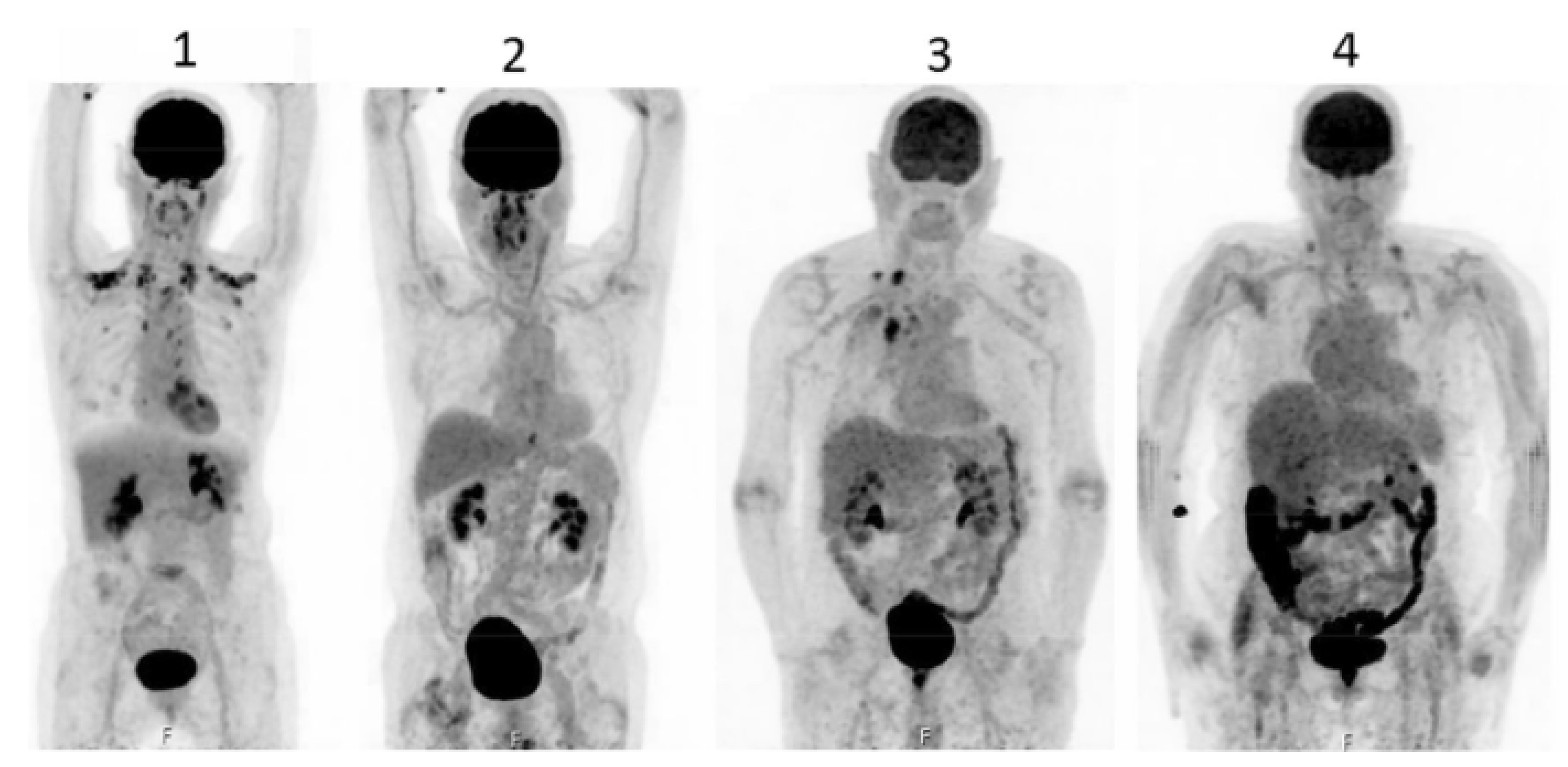 Livers 05 00035 g003 Livers 05 00035 g003